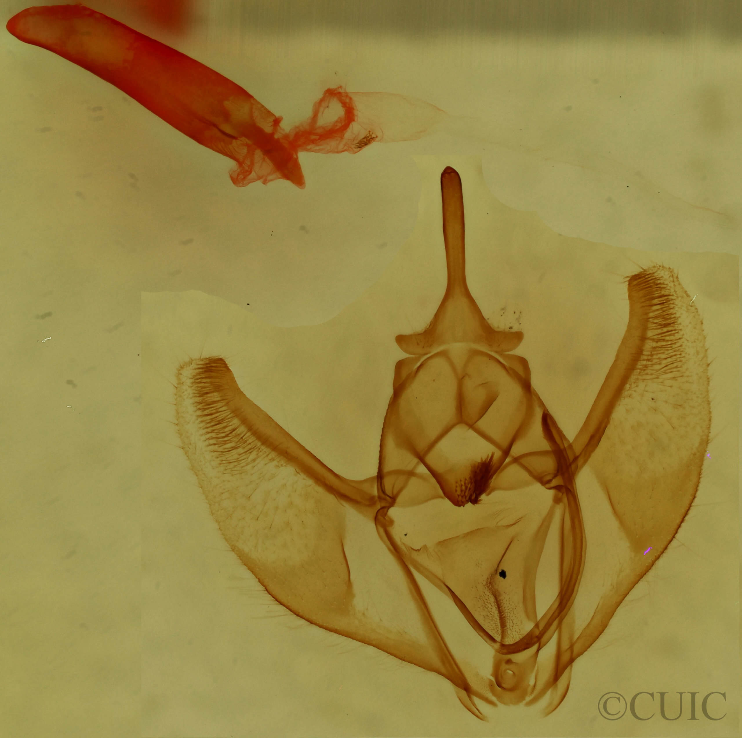 genitalia view of adult Caripeta interalbicans