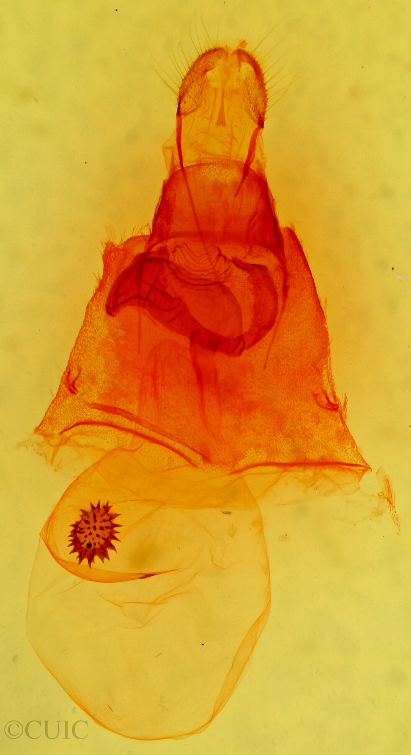 genitalia view of adult Caripeta interalbicans