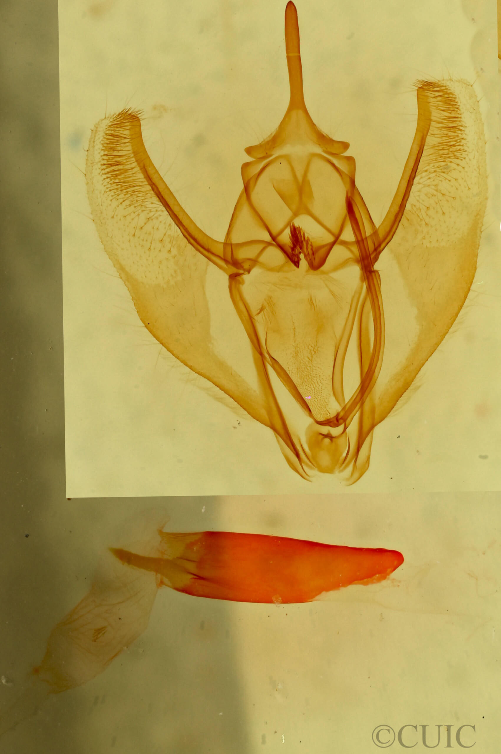 genitalia view of adult Caripeta aequaliaria