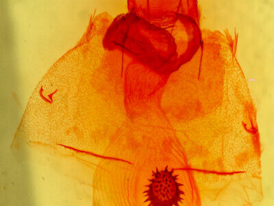genitalia view of adult Caripeta aequaliaria