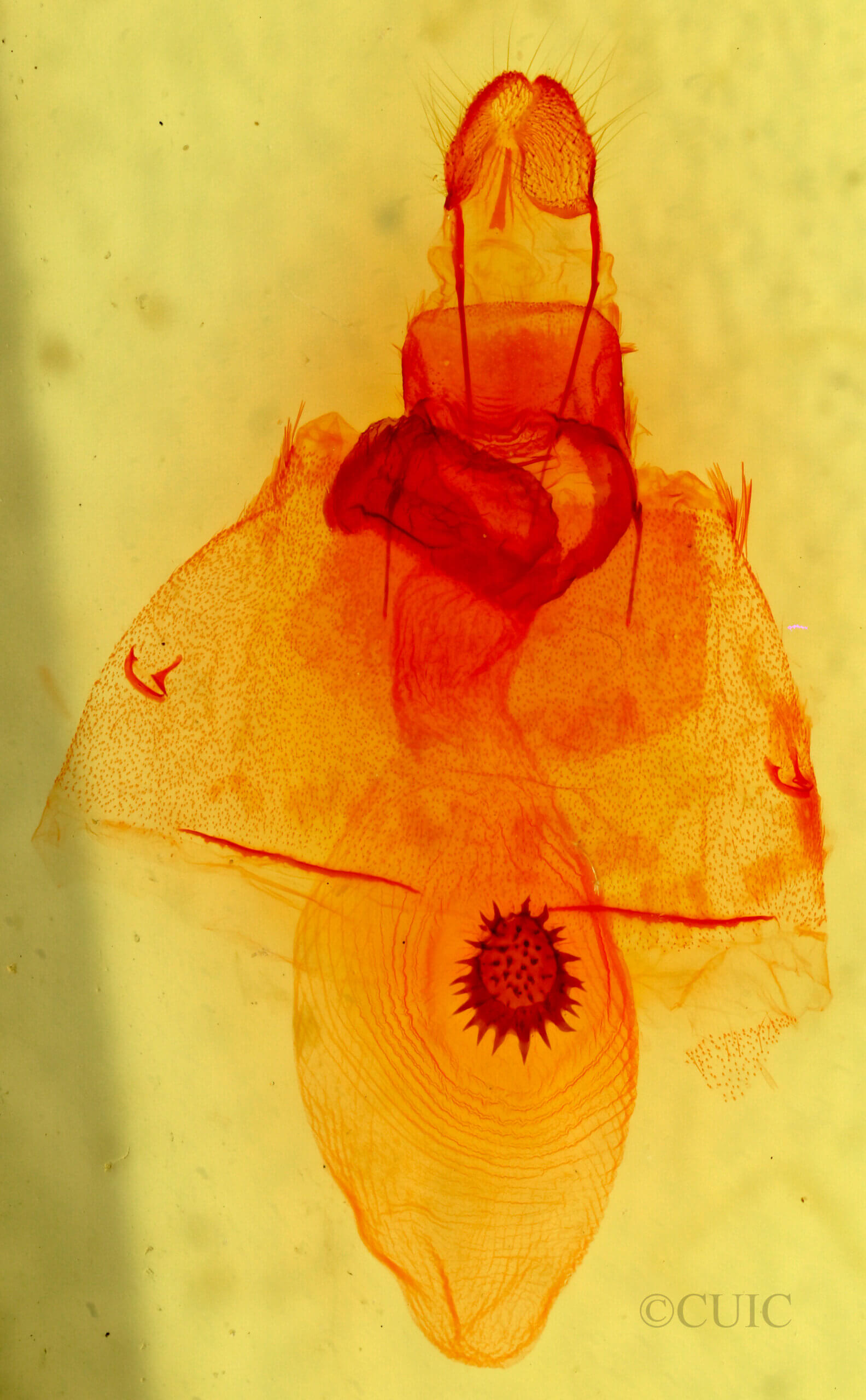 genitalia view of adult Caripeta aequaliaria