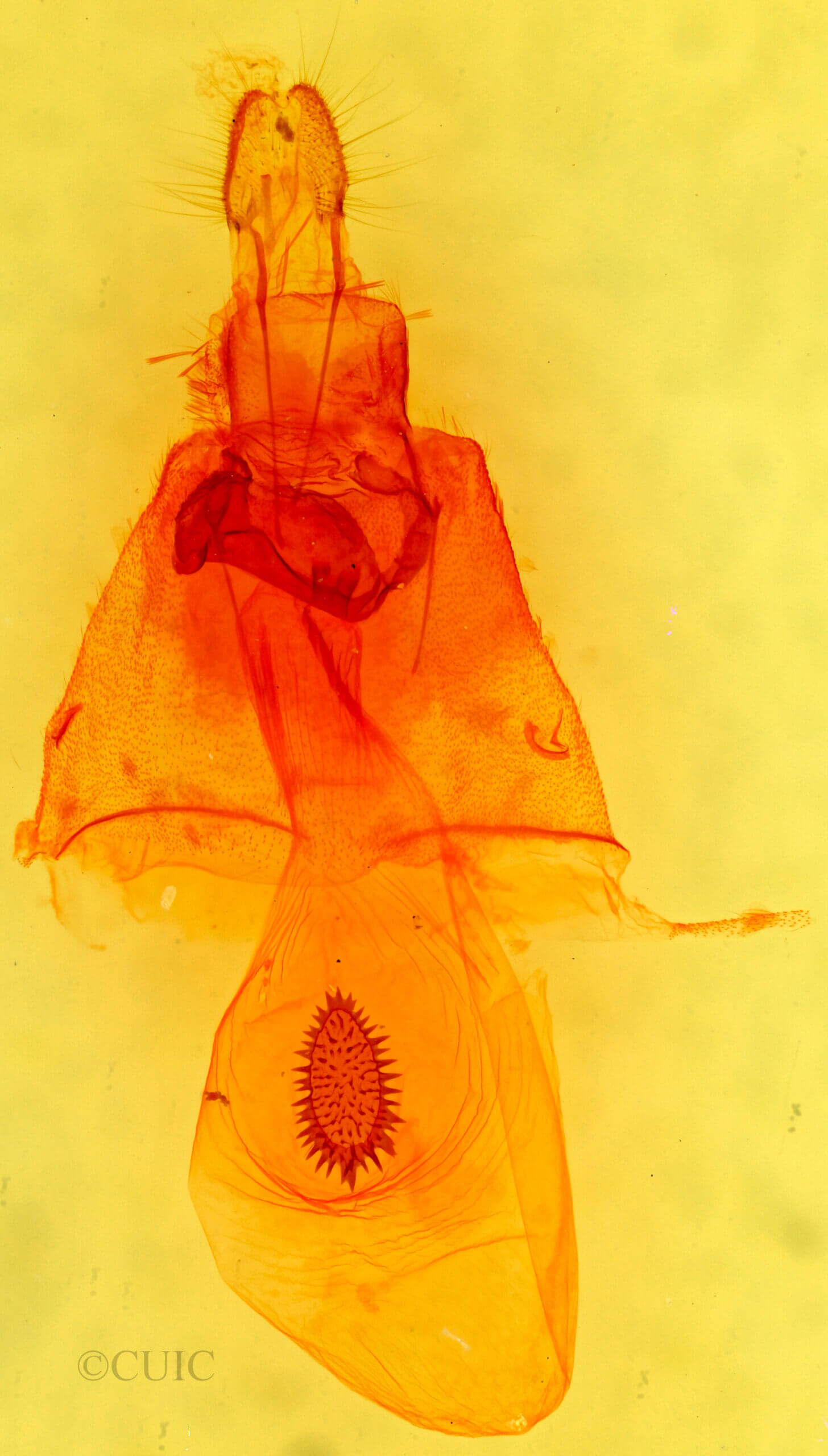 genitalia view of adult Caripeta suffusata
