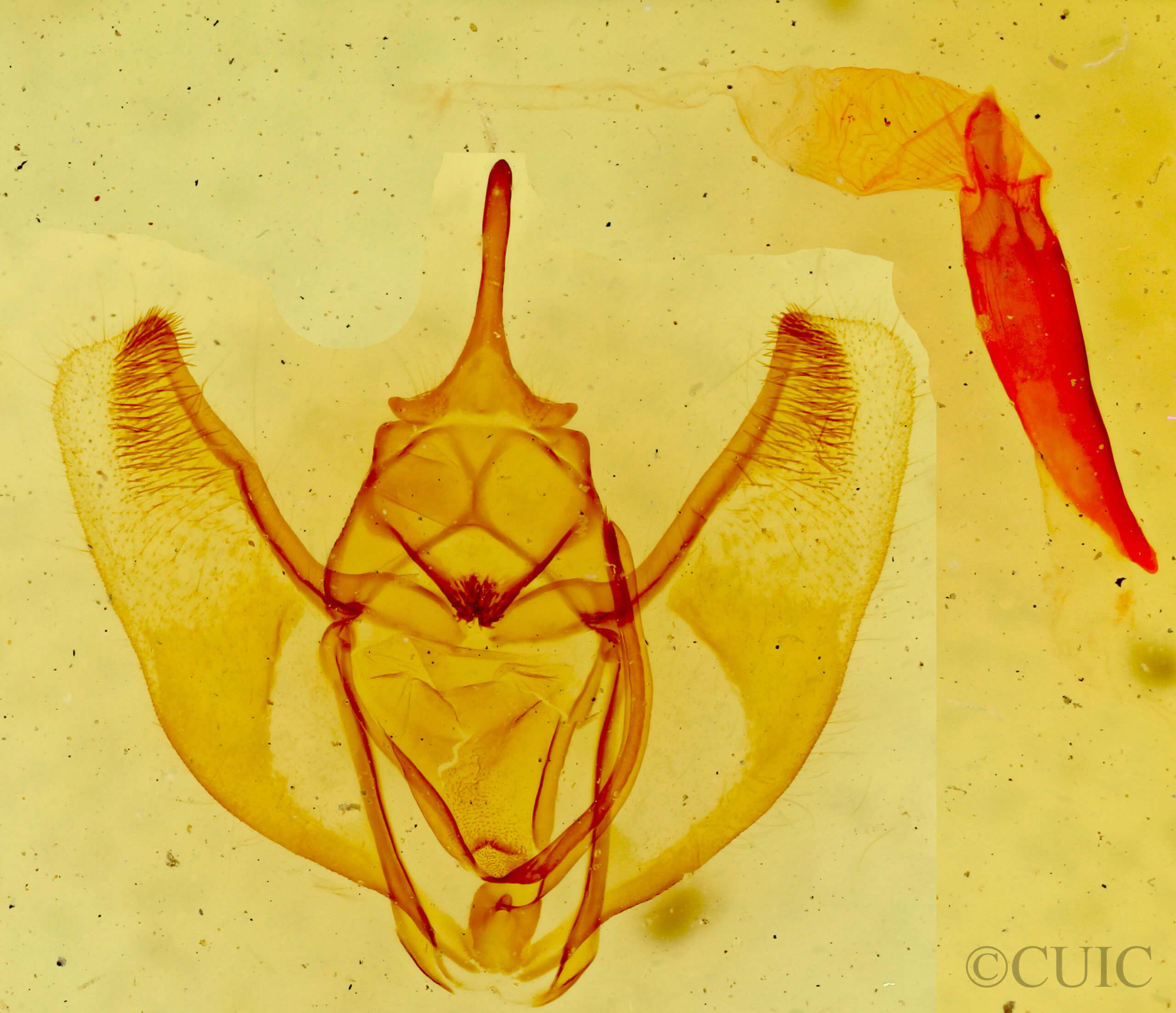 genitalia view of adult Caripeta aequaliaria