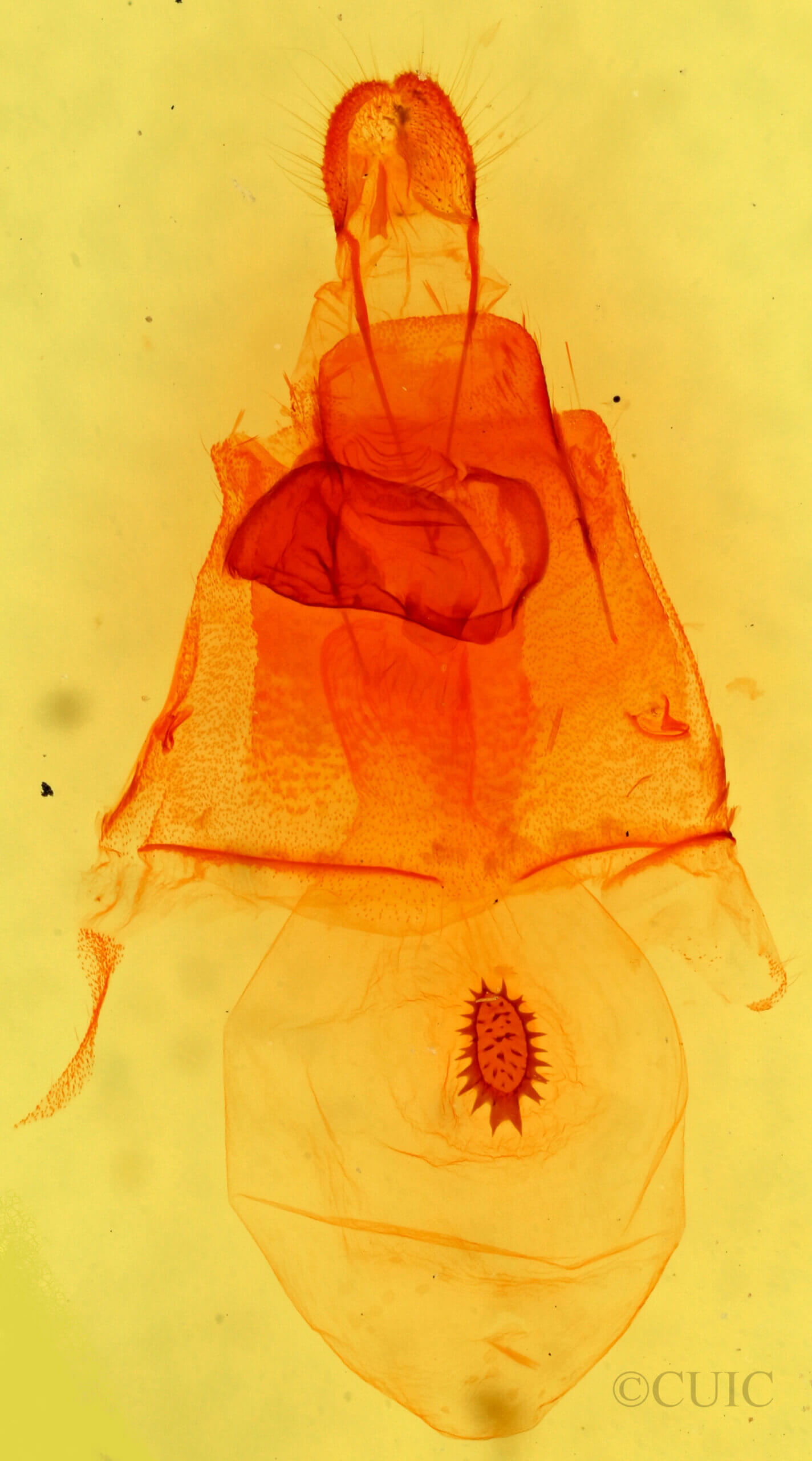 genitalia view of adult Caripeta aequaliaria