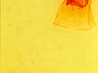 genitalia view of adult Caripeta aequaliaria