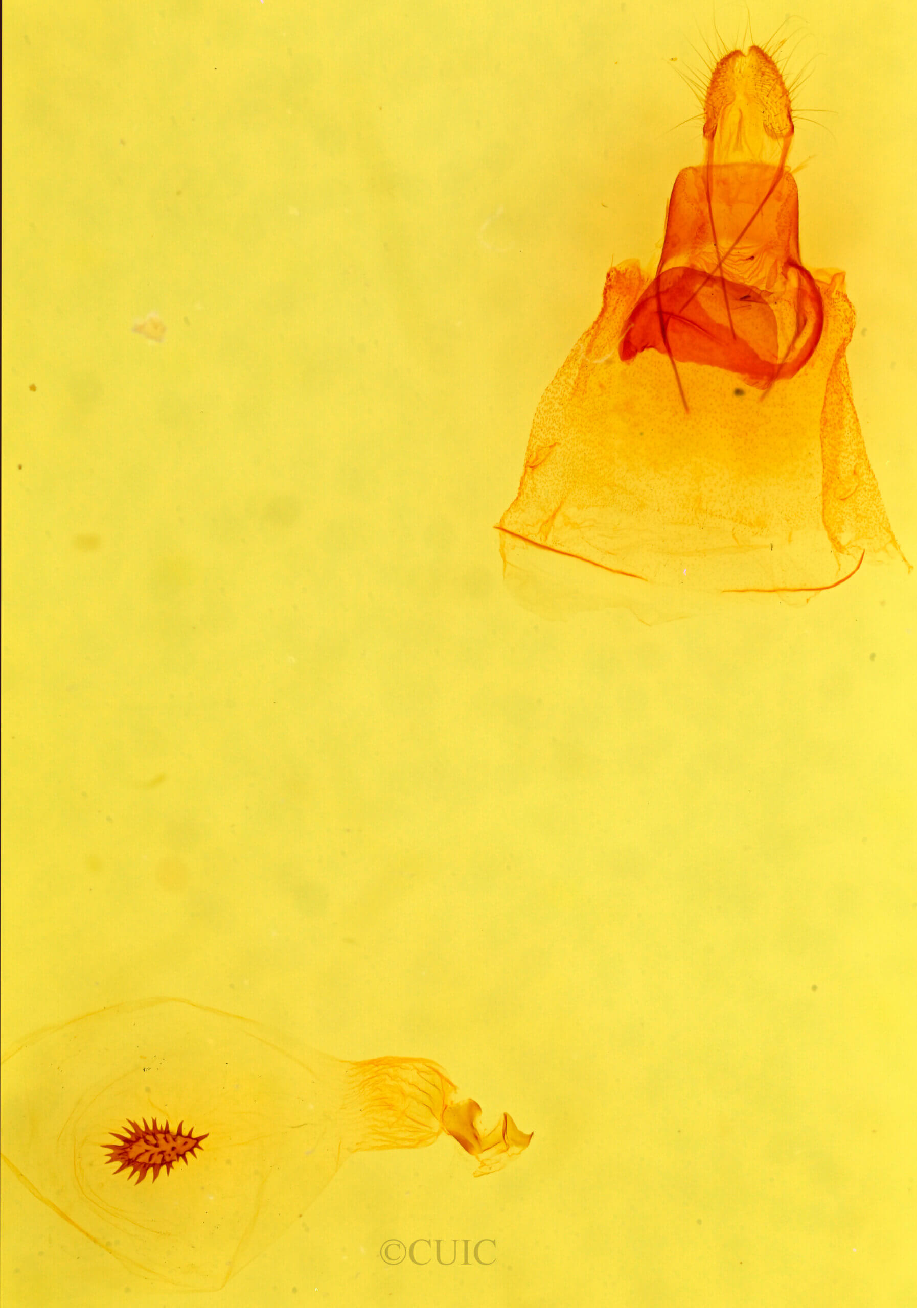 genitalia view of adult Caripeta aequaliaria