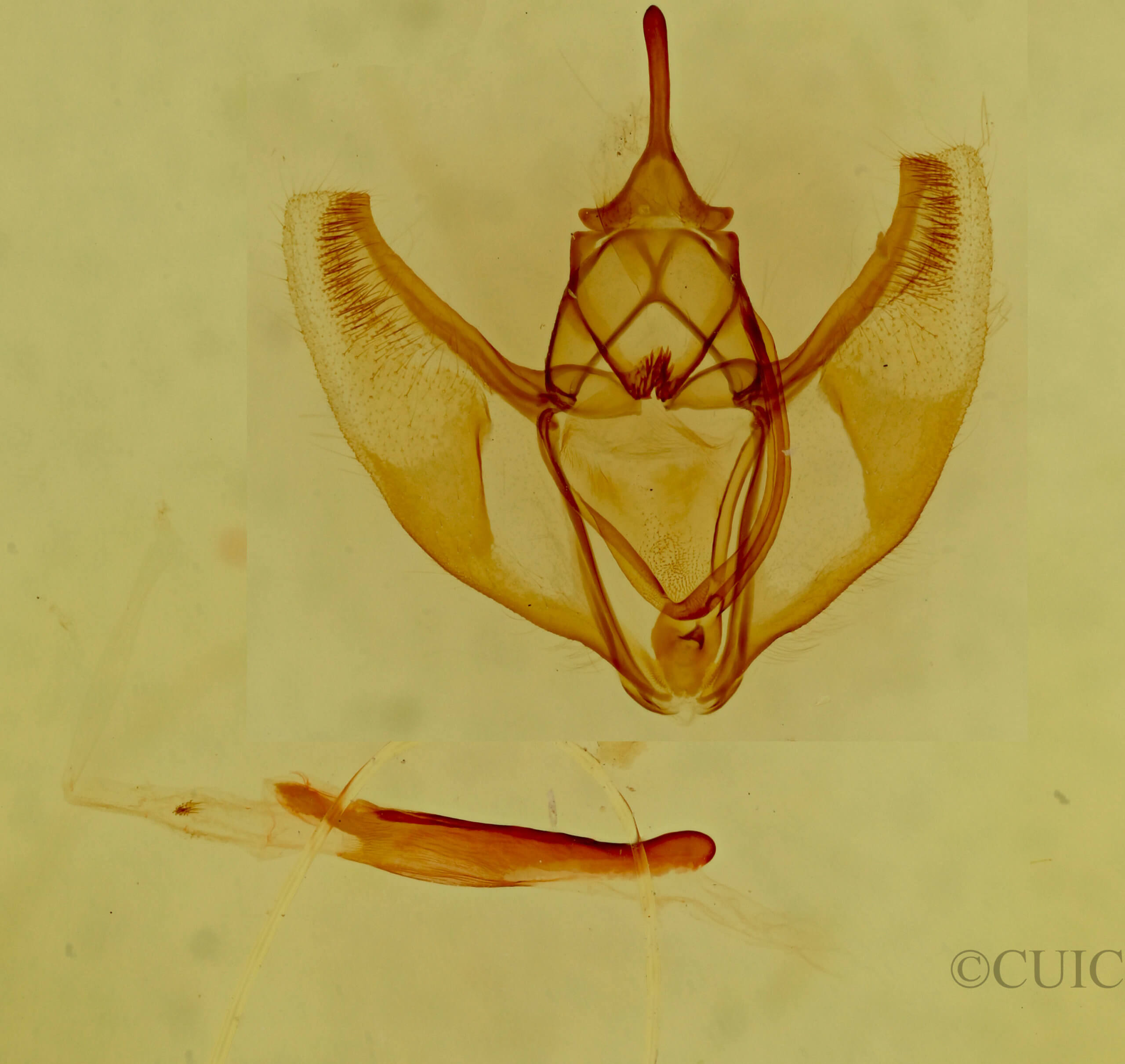 genitalia view of adult Caripeta aequaliaria