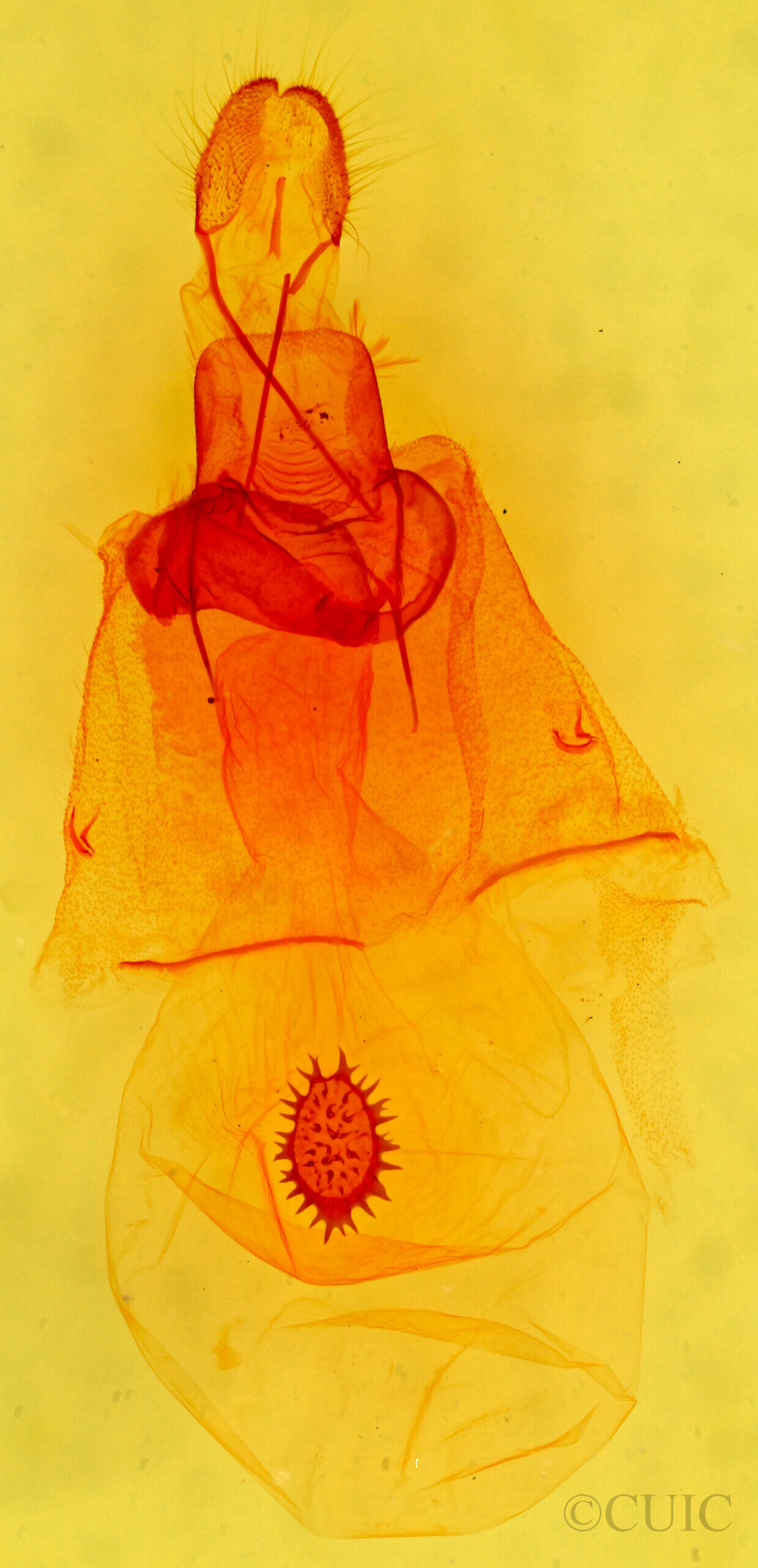genitalia view of adult Caripeta aequaliaria