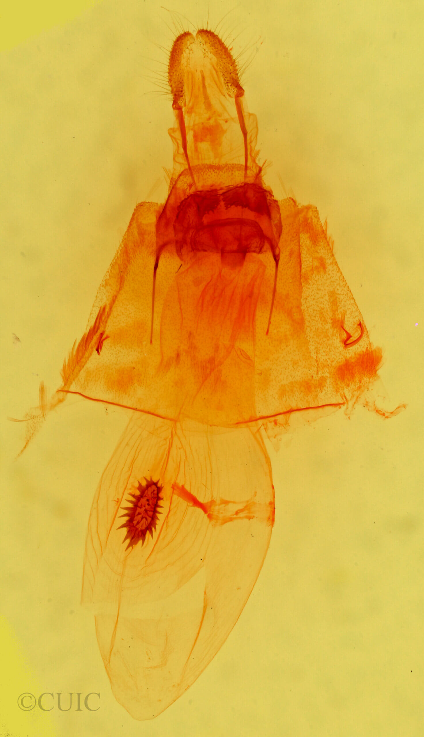 genitalia view of adult Caripeta piniata