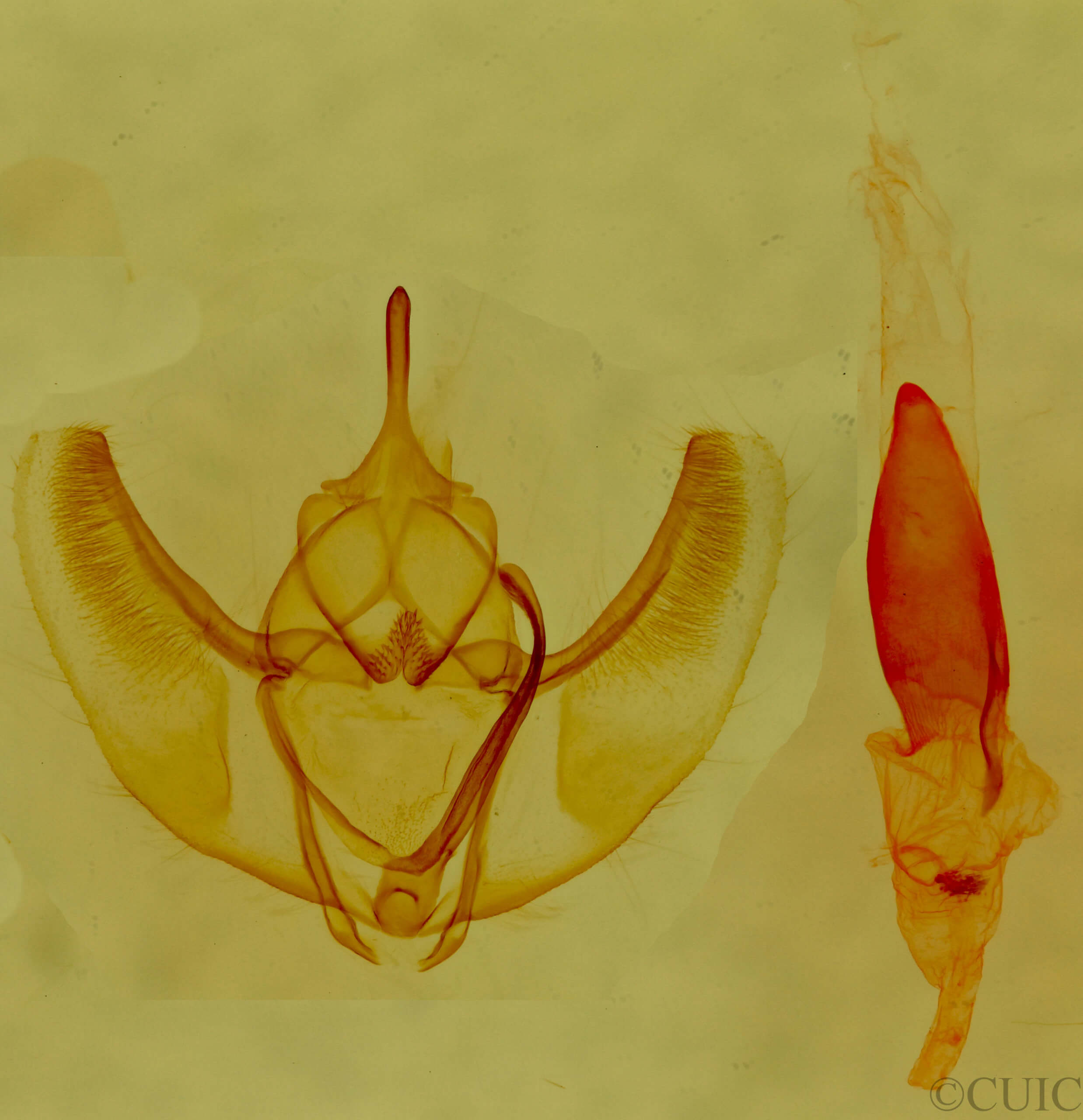 genitalia view of adult Caripeta angustiorata