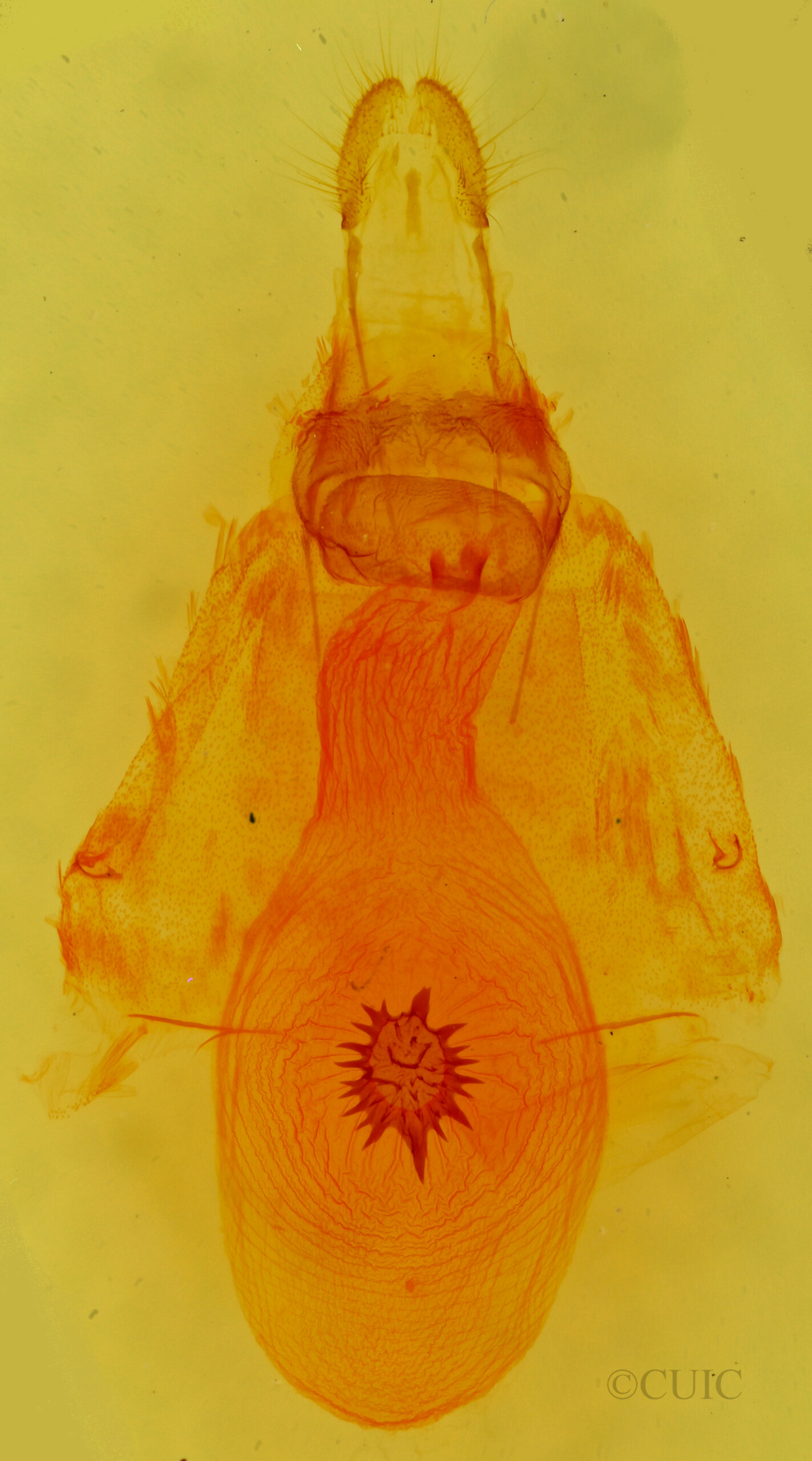 genitalia view of adult Caripeta angustiorata