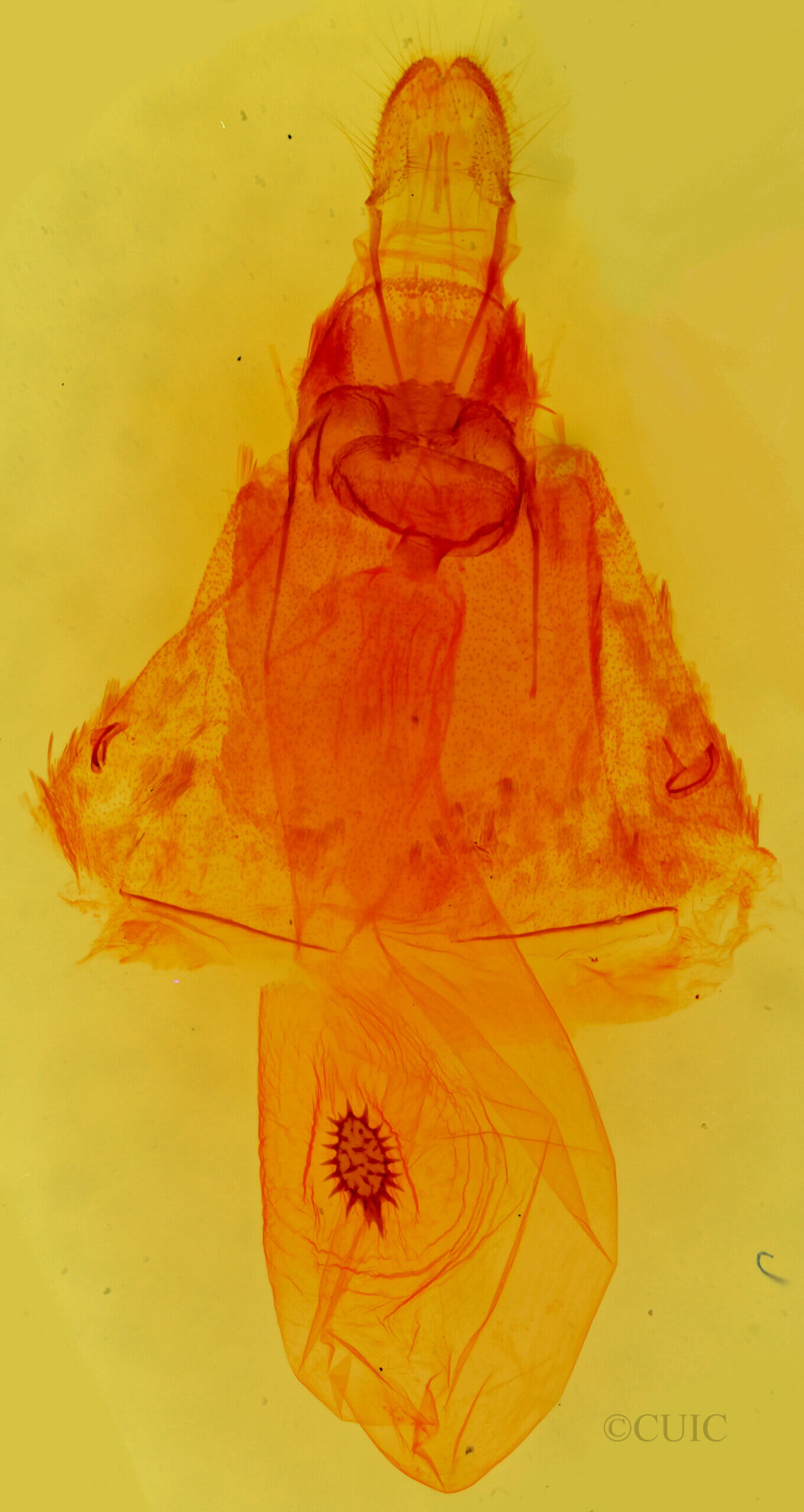 genitalia view of adult Caripeta latiorata