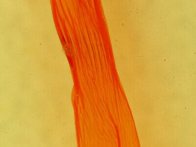 genitalia view of adult Caripeta ocellaria