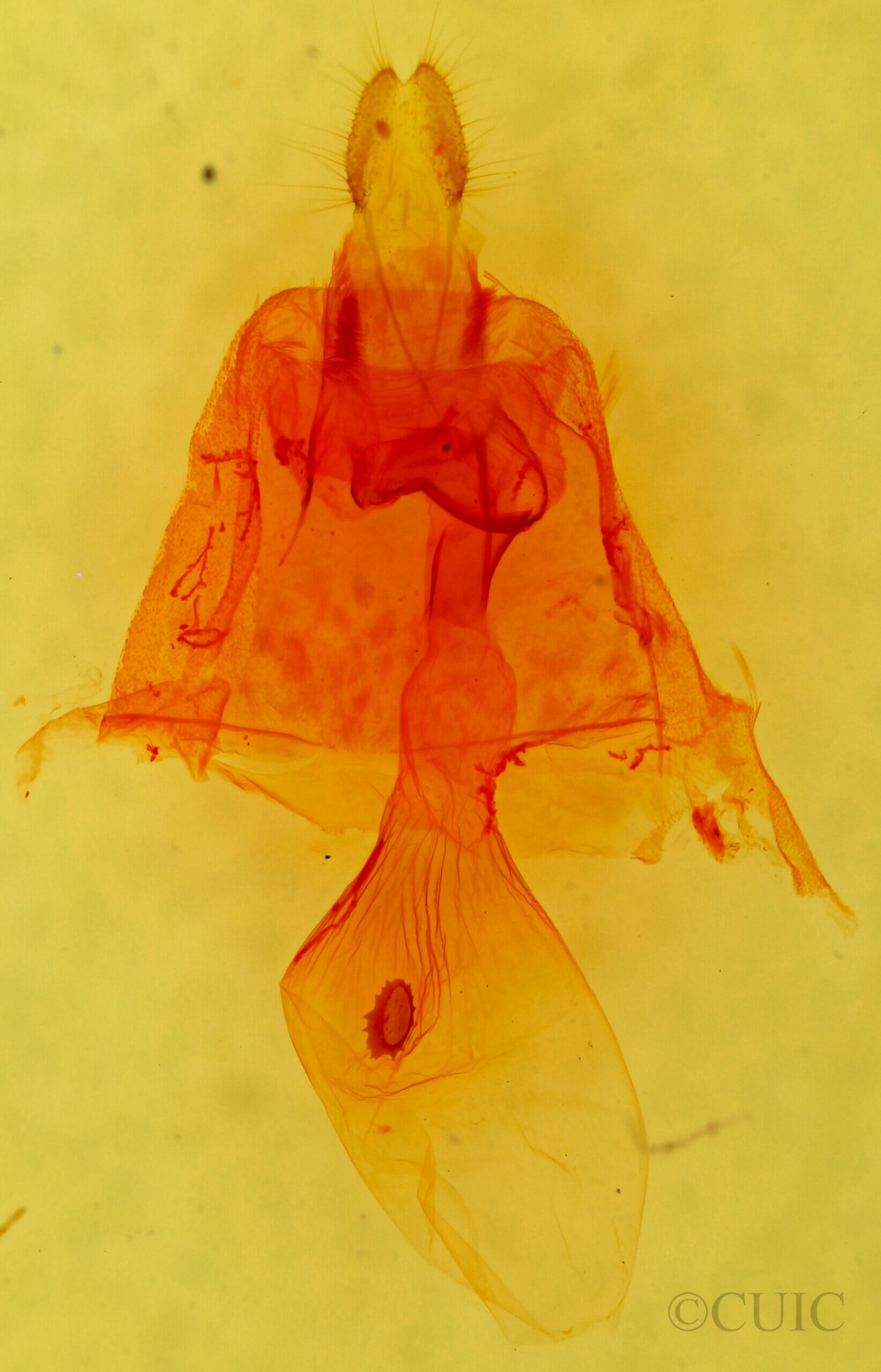 genitalia view of adult Caripeta hilumaria
