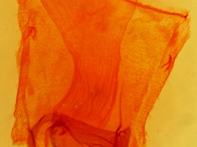 genitalia view of adult Caripeta aequaliaria