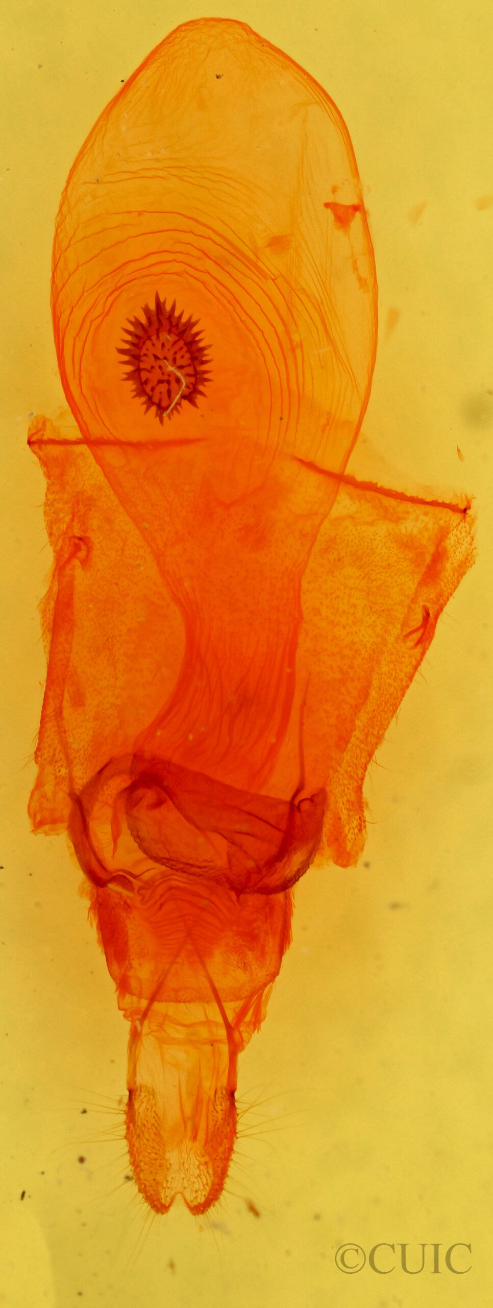 genitalia view of adult Caripeta aequaliaria