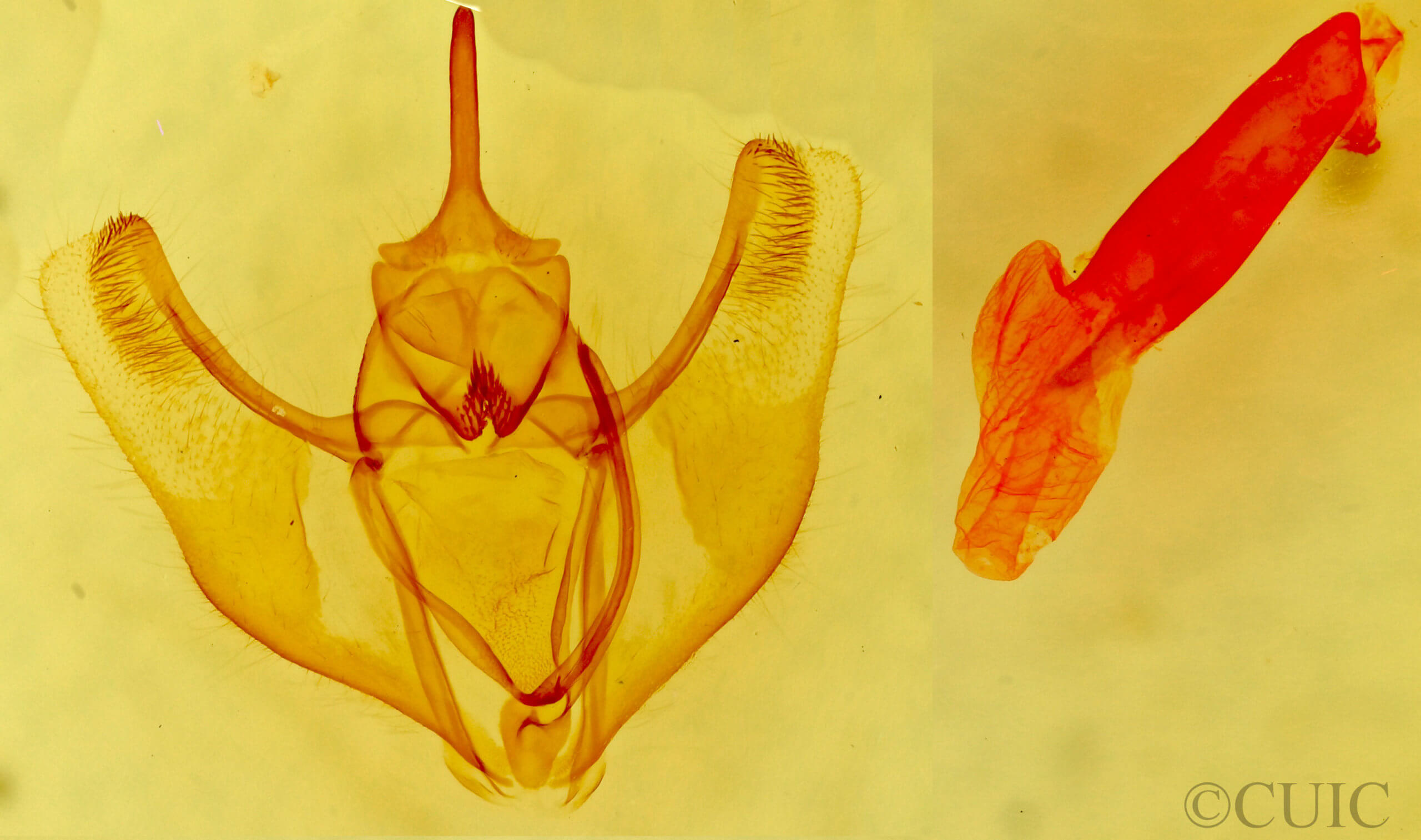 genitalia view of adult Caripeta aequaliaria