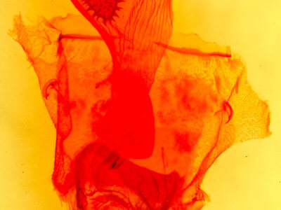 genitalia view of adult Caripeta aequaliaria