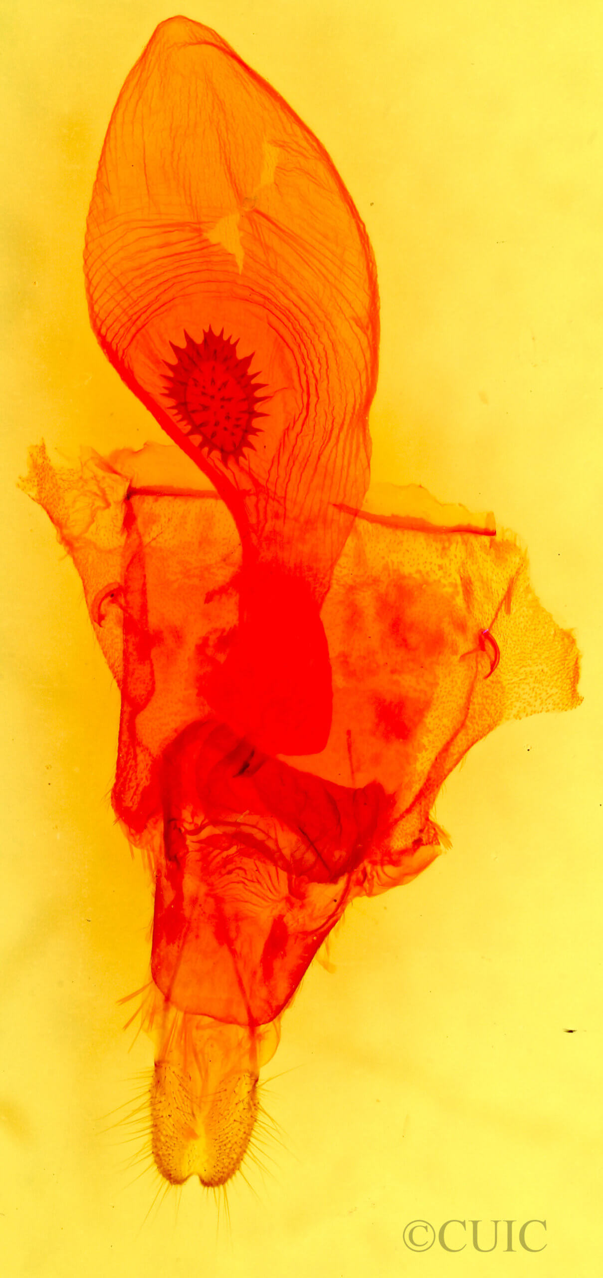 genitalia view of adult Caripeta aequaliaria