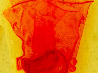 genitalia view of adult Caripeta interalbicans