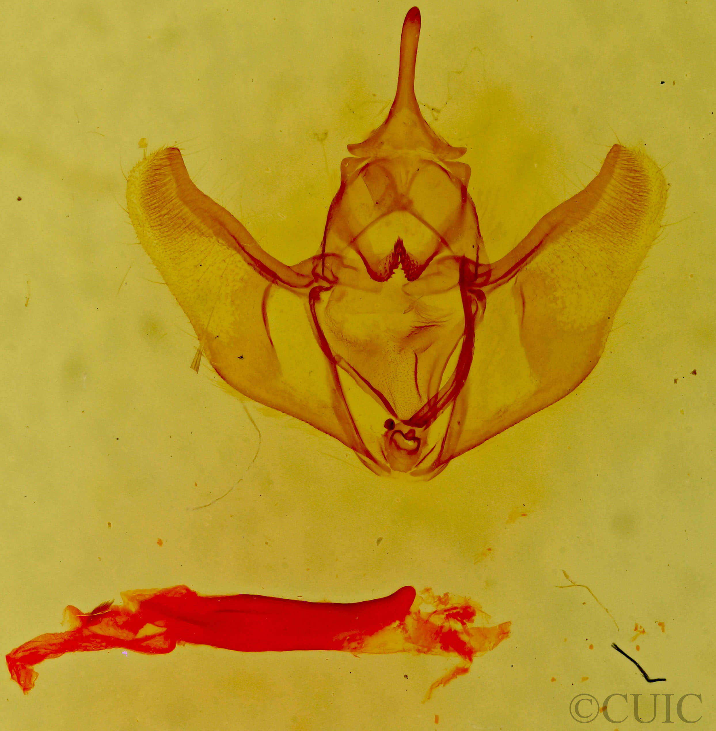 genitalia view of adult Caripeta interalbicans