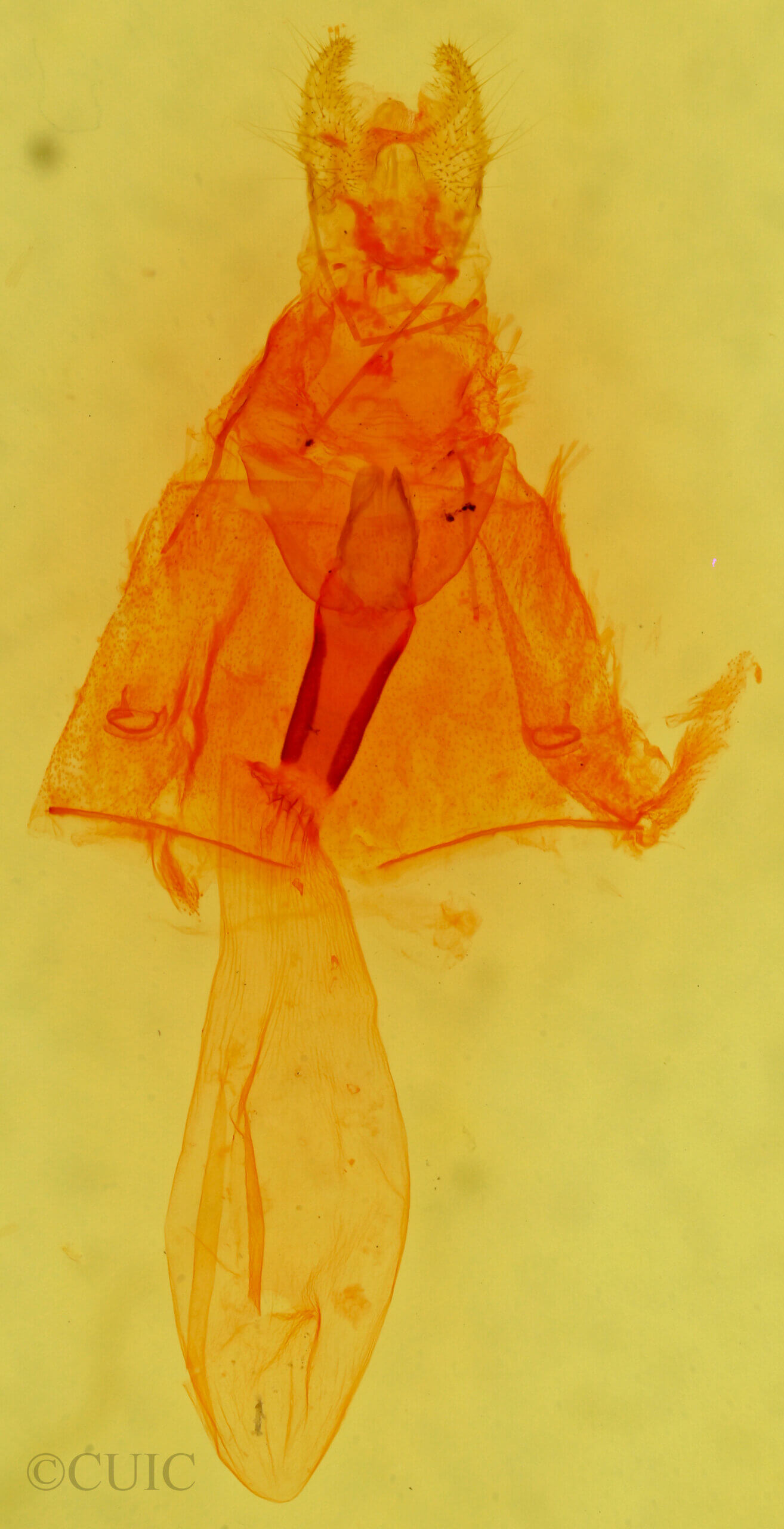 genitalia view of adult Sabulodes sericeata