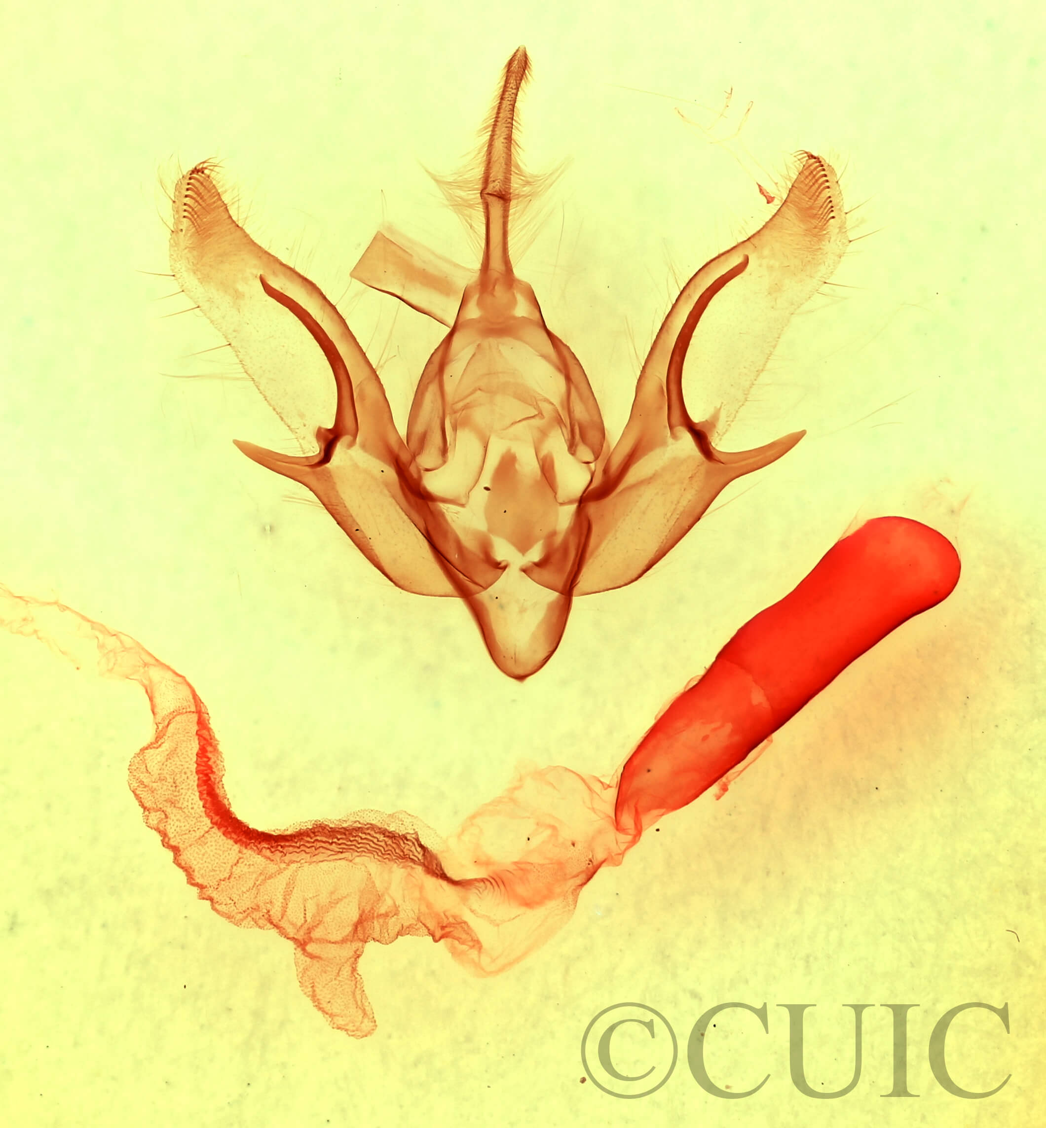 genitalia view of adult Euxoa maderensis