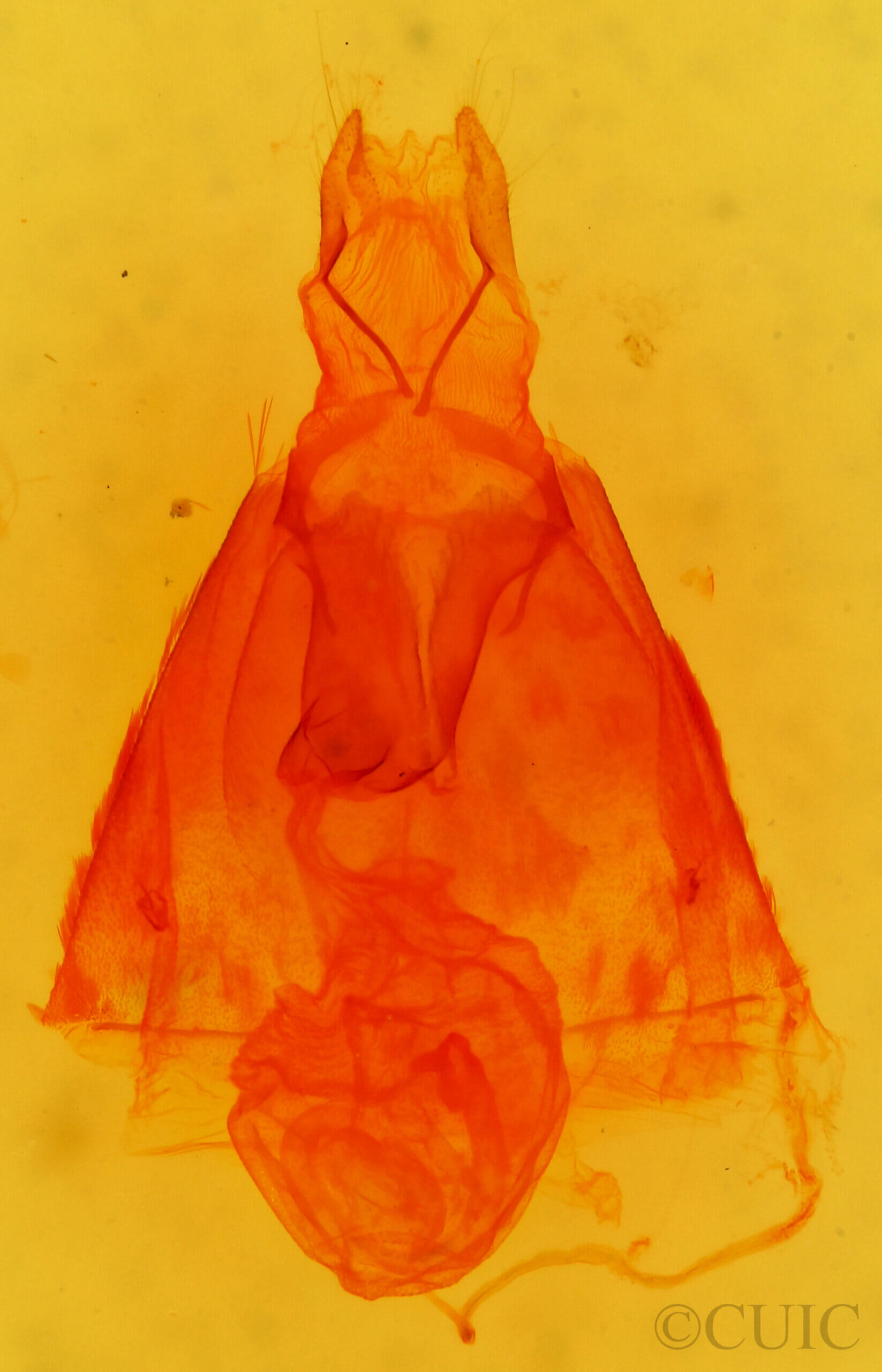 genitalia view of adult Amolita fessa