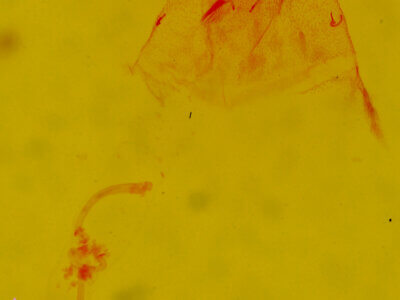 genitalia view of adult Amolita roseola