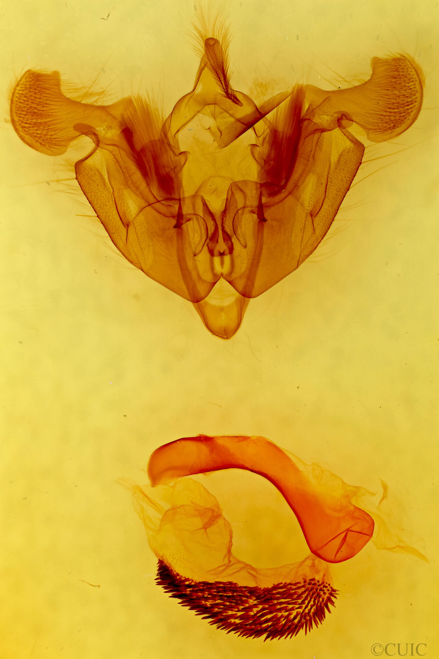 genitalia view of adult Trichordestra liquida