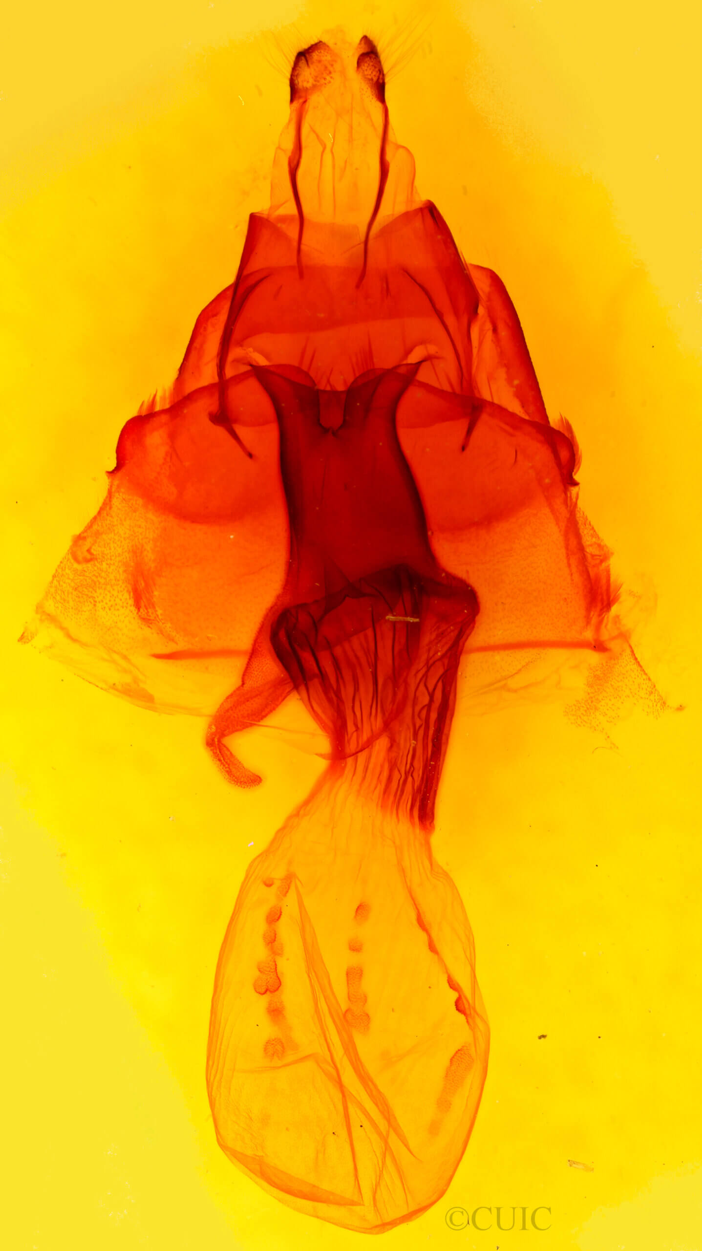 genitalia view of adult Melanchra adjuncta