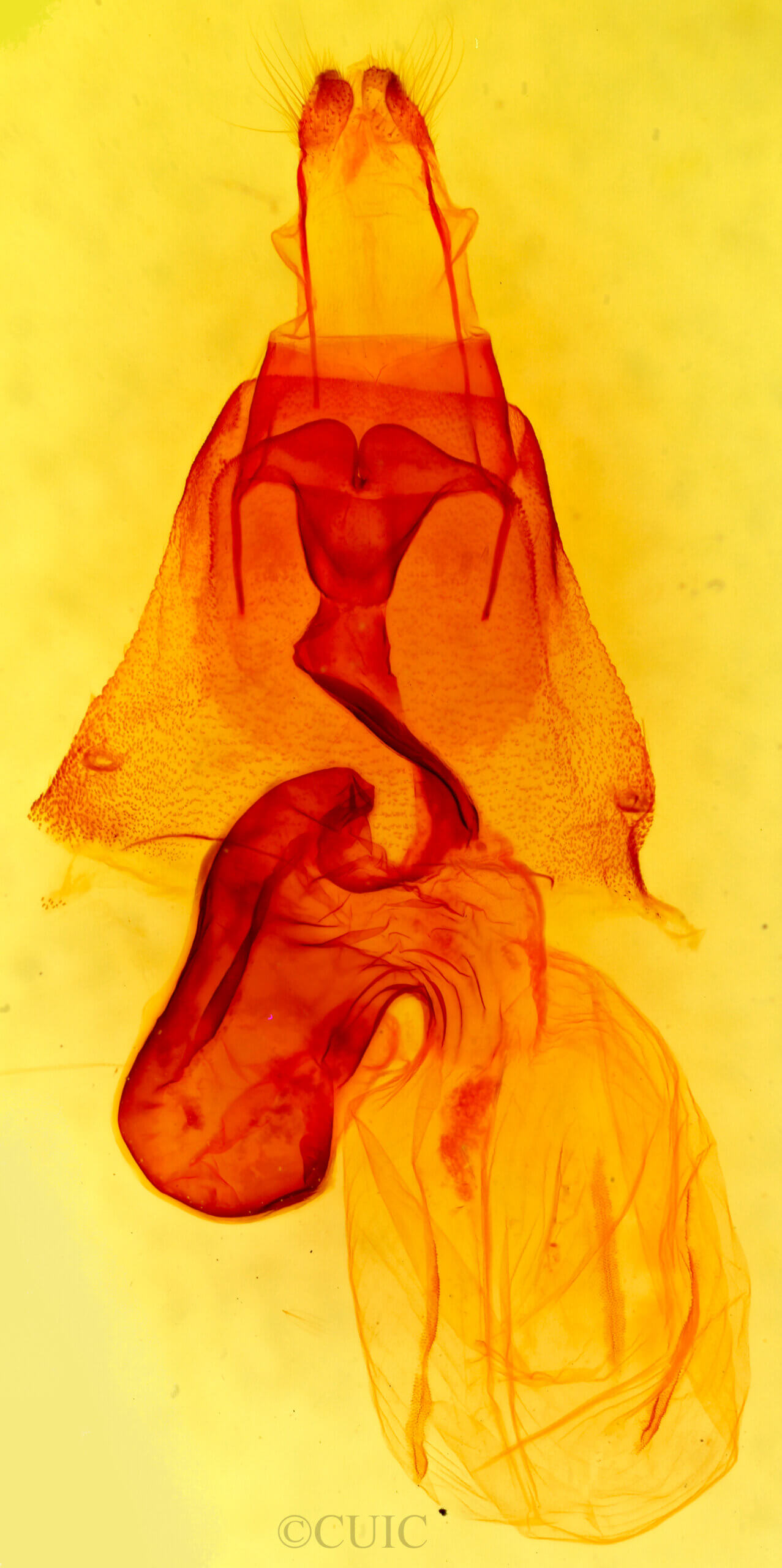 genitalia view of adult Trichordestra legitima