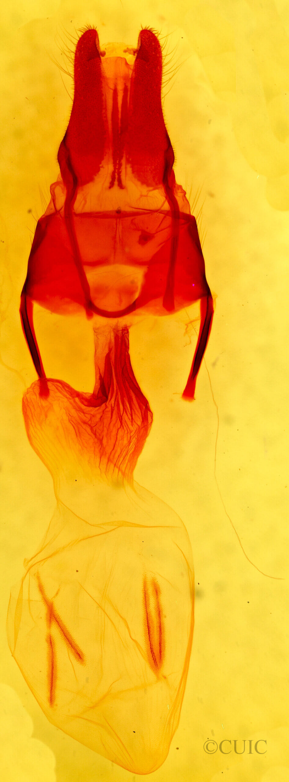 genitalia view of adult Apamea inficita conradi