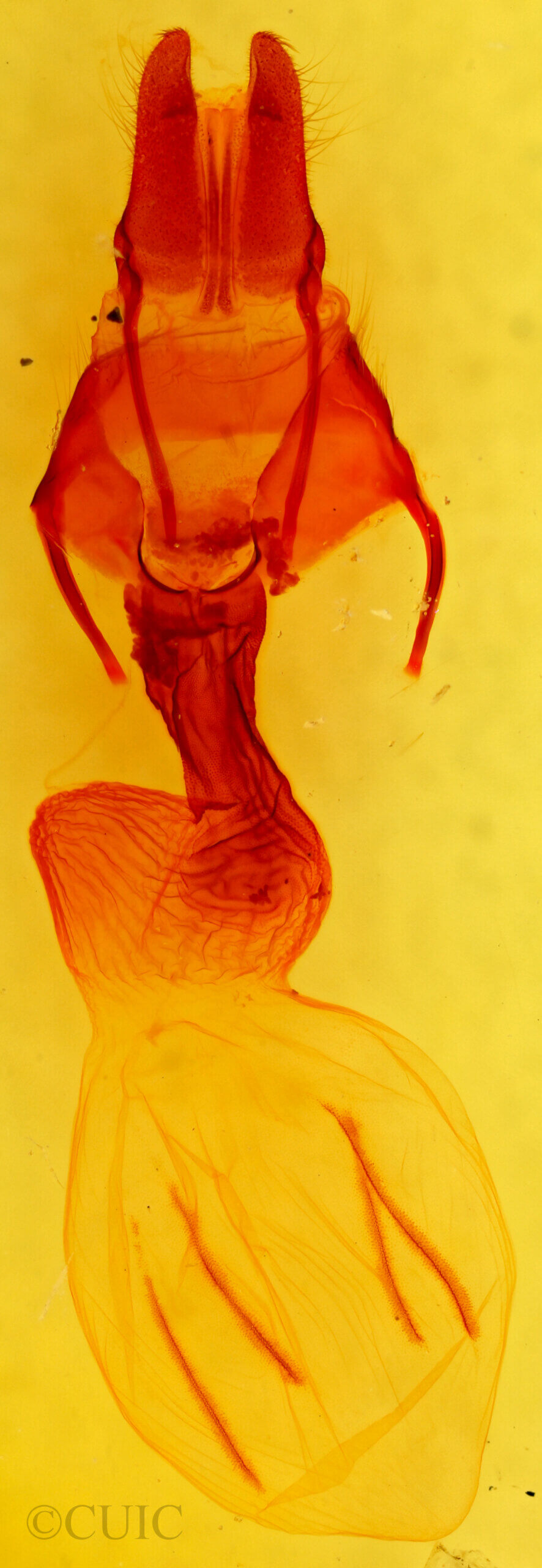 genitalia view of adult Apamea geminimacula