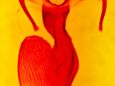 genitalia view of adult Apamea burgessi ona