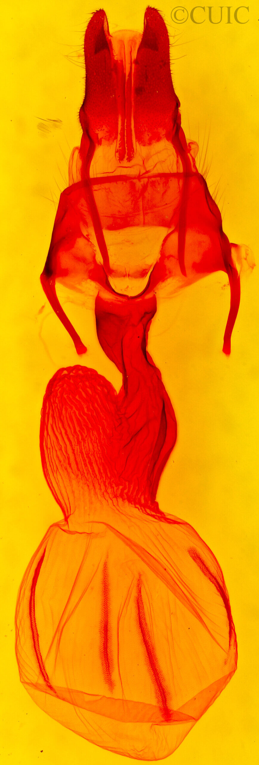 genitalia view of adult Apamea burgessi ona