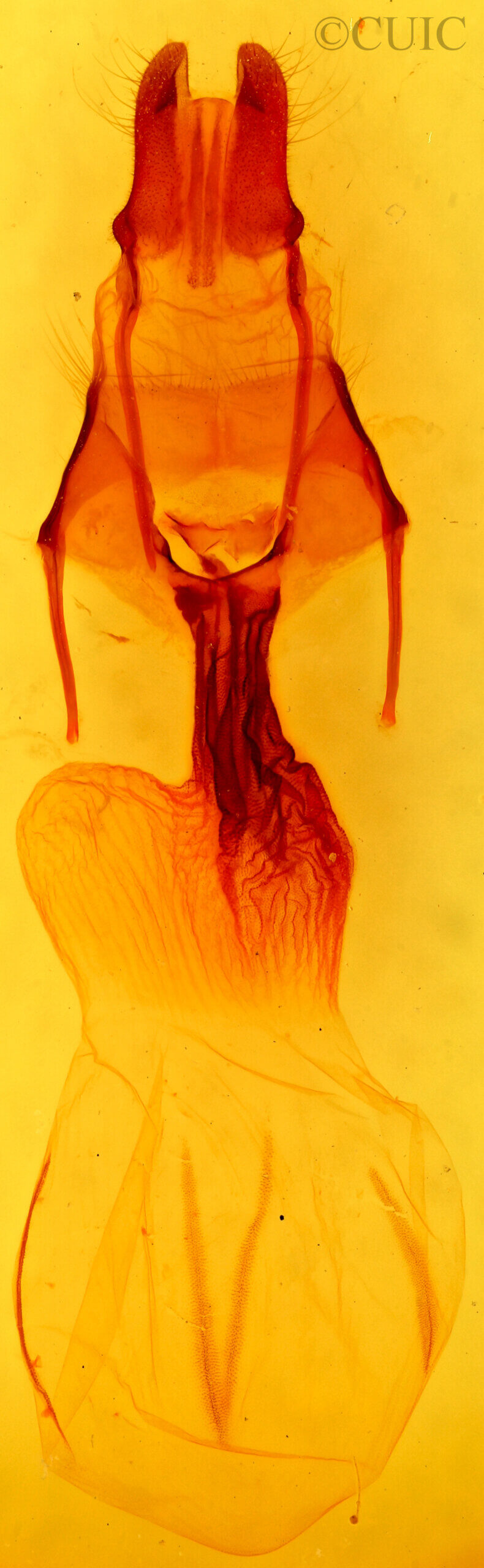 genitalia view of adult Apamea atrosuffusa