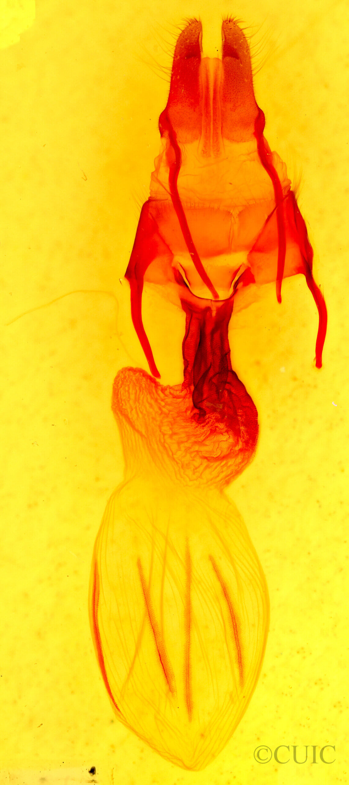 genitalia view of adult Apamea atrosuffusa