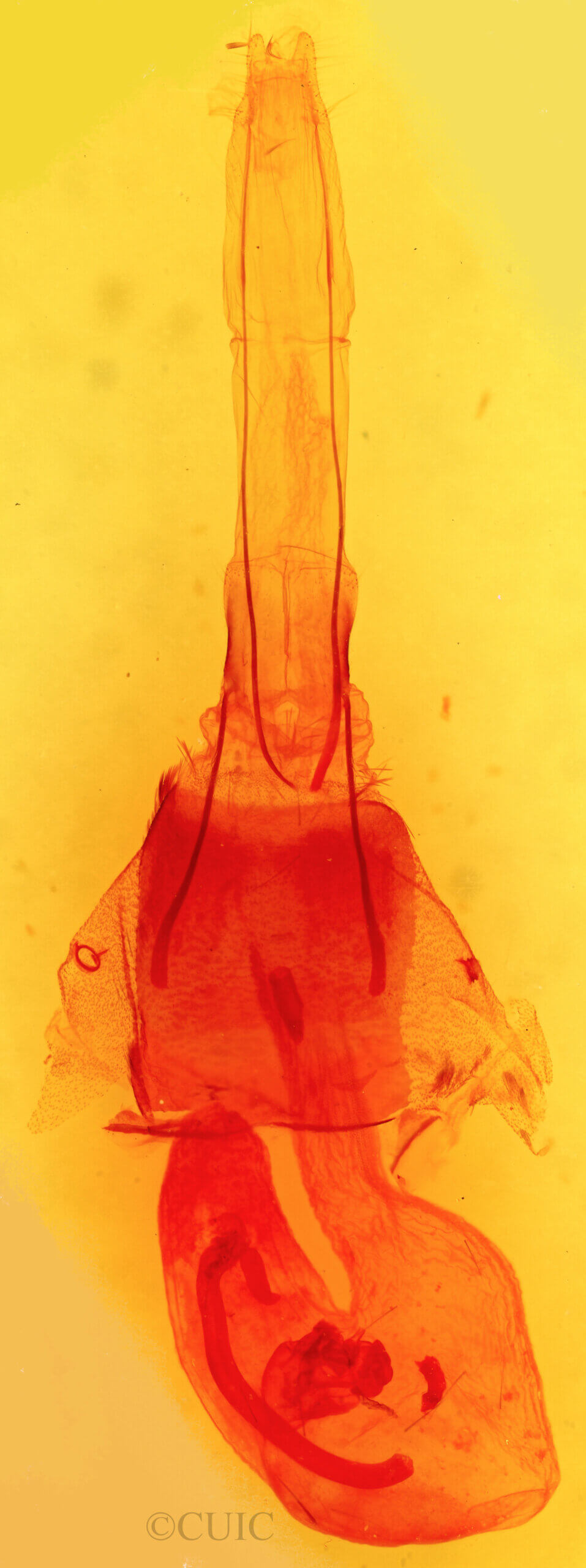 genitalia view of adult Ruacodes tela