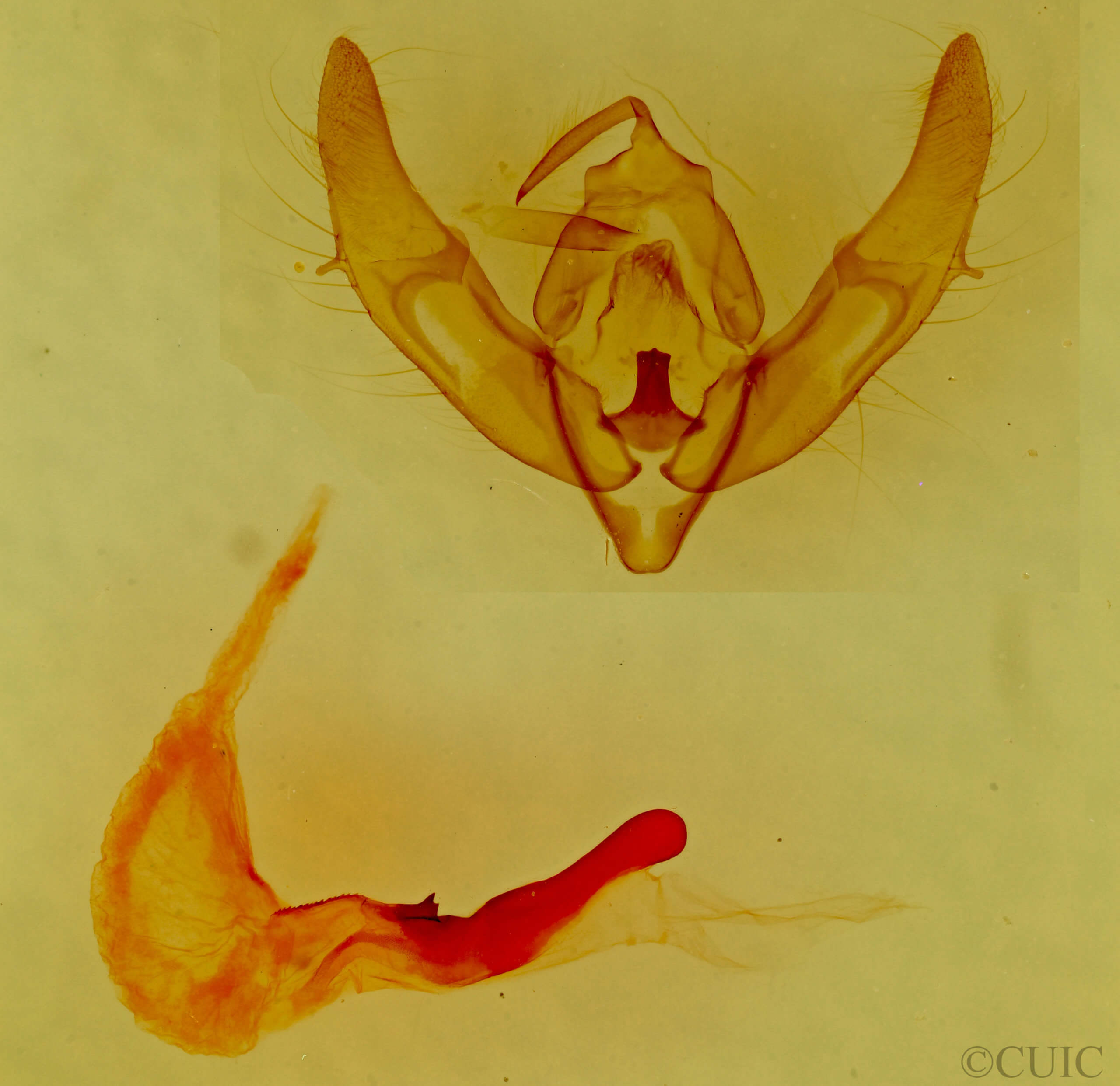 genitalia view of adult Xestia xanthographa
