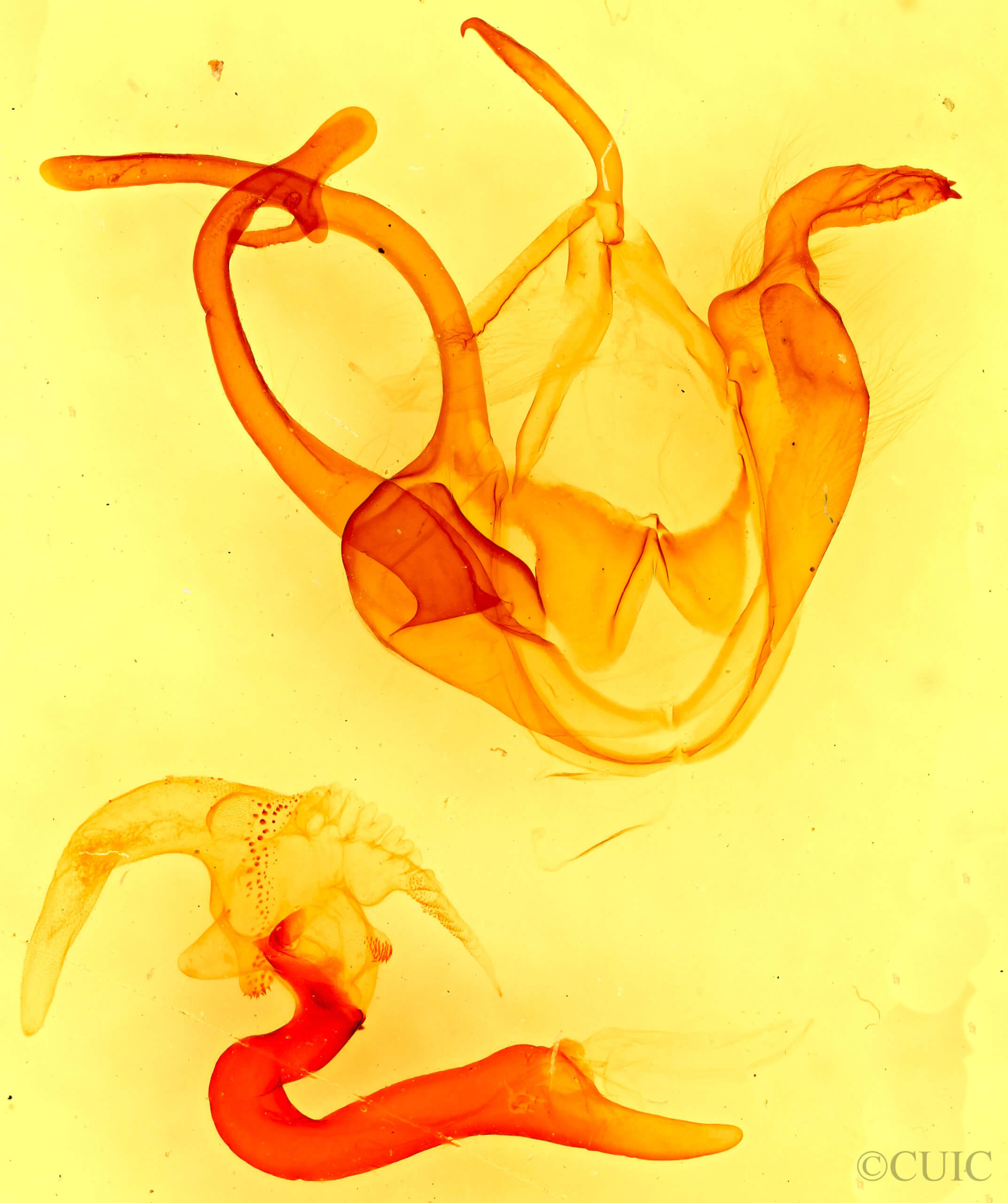 genitalia view of adult Zale lunata