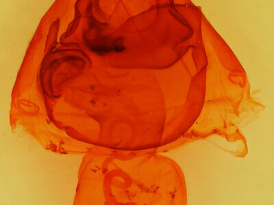 genitalia view of adult Zale lunata