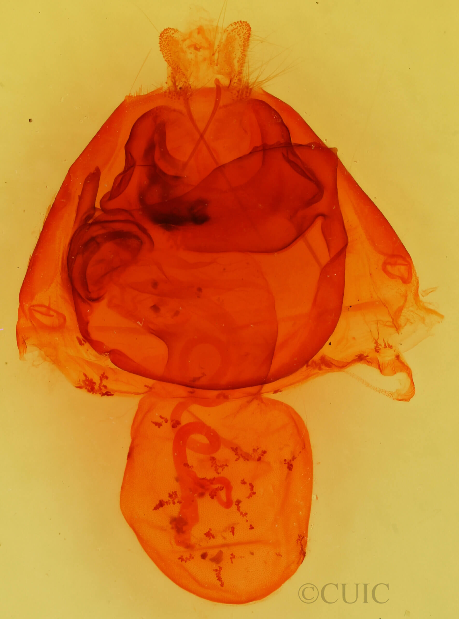 genitalia view of adult Zale lunata