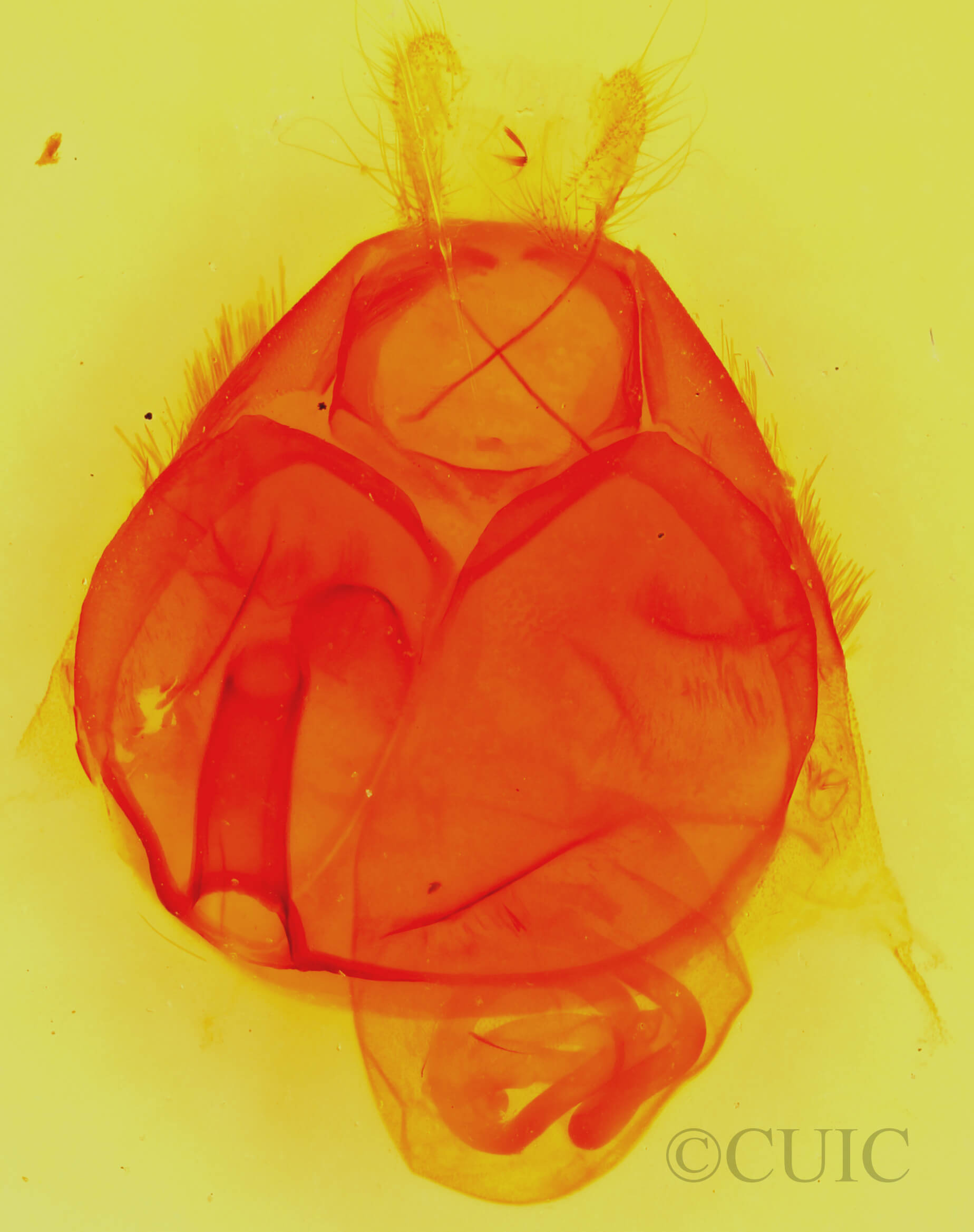 genitalia view of adult Zale aeruginosa