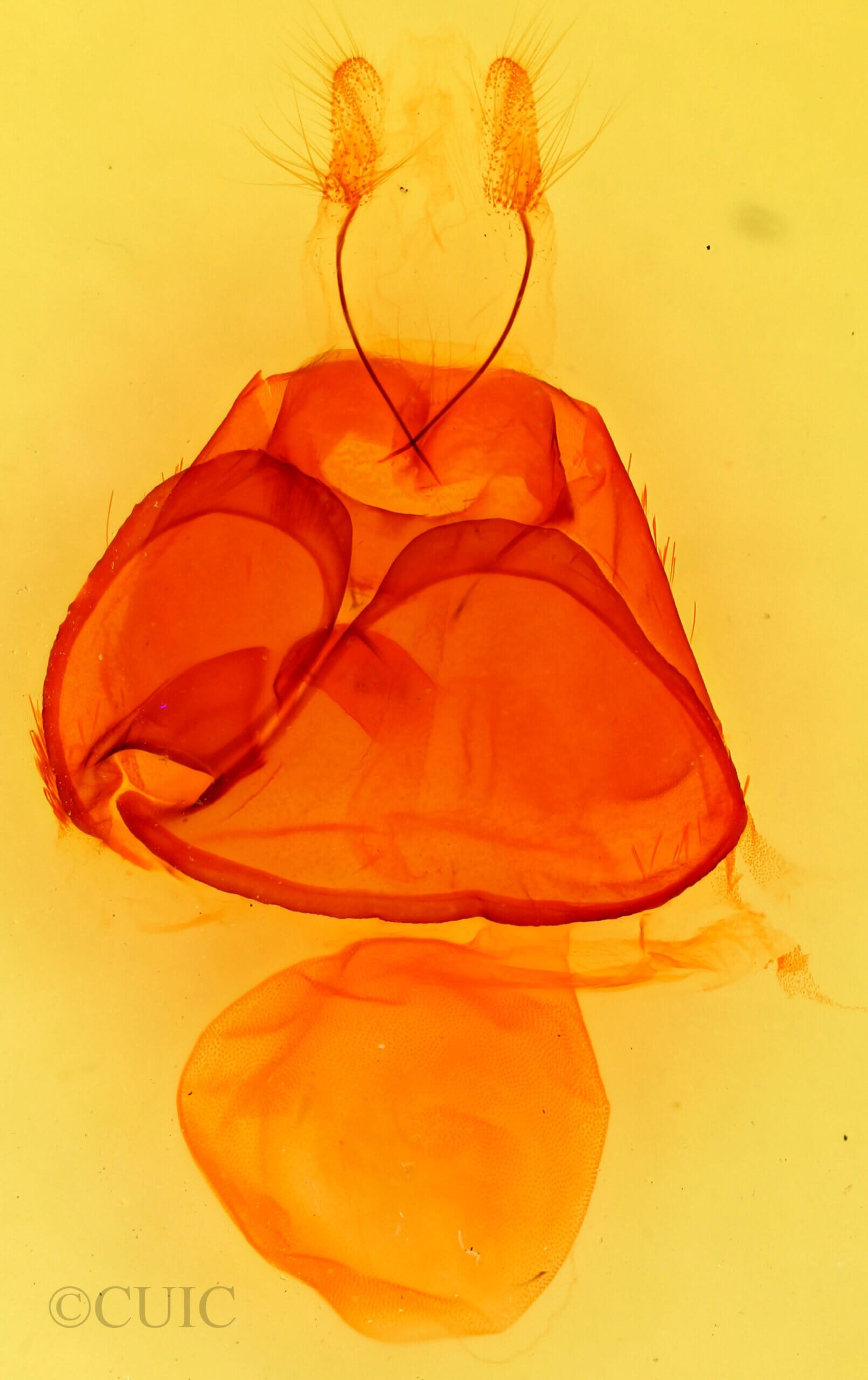 genitalia view of adult Zale colorado