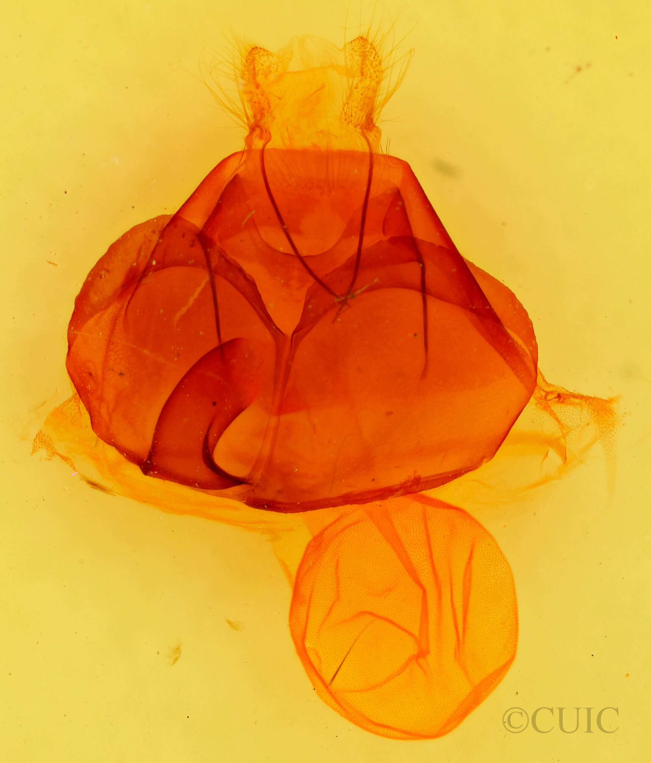 genitalia view of adult Zale  unilineata