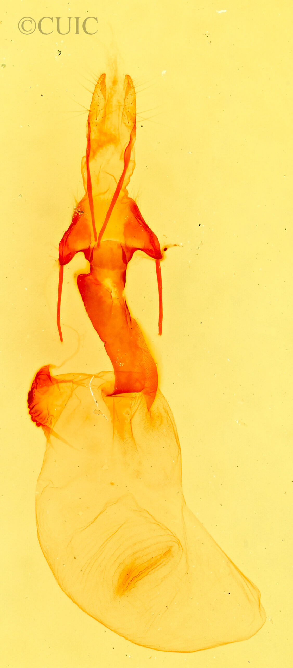 genitalia view of adult Lacinipolia mimula