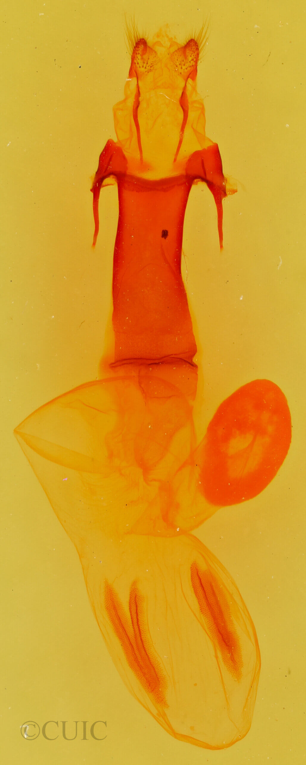 genitalia view of adult Egira variabilis
