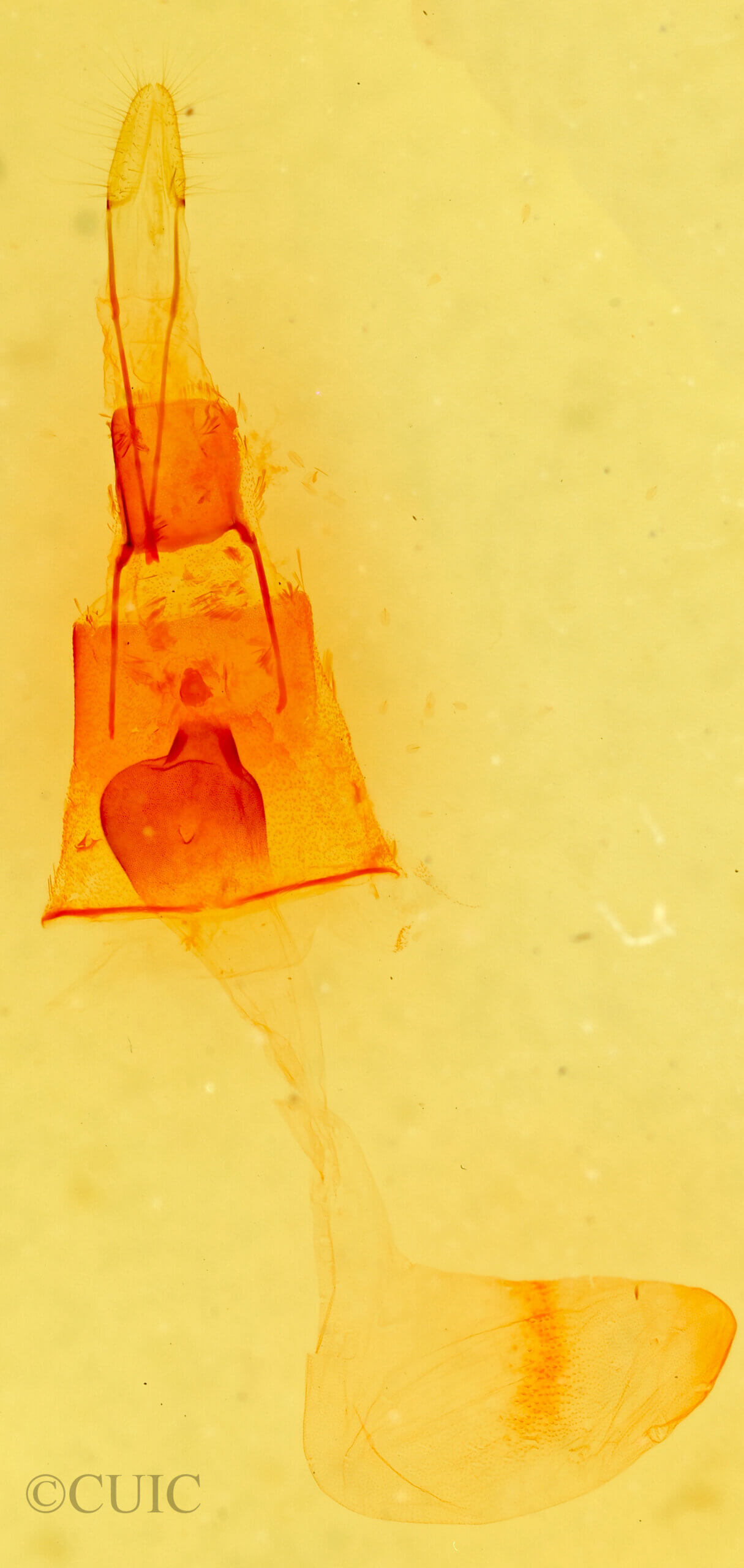 genitalia view of adult Galenara glaucaria