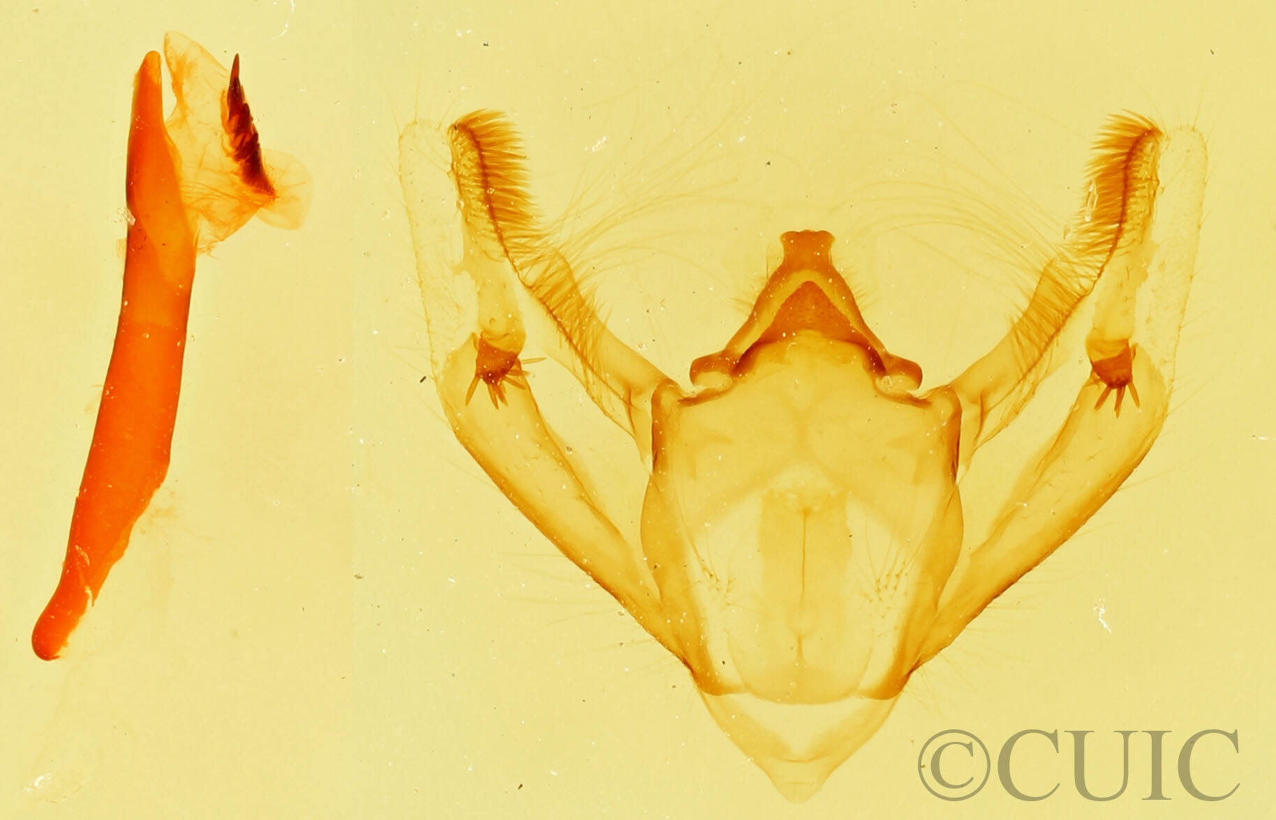 genitalia view of adult Galenara lixaria